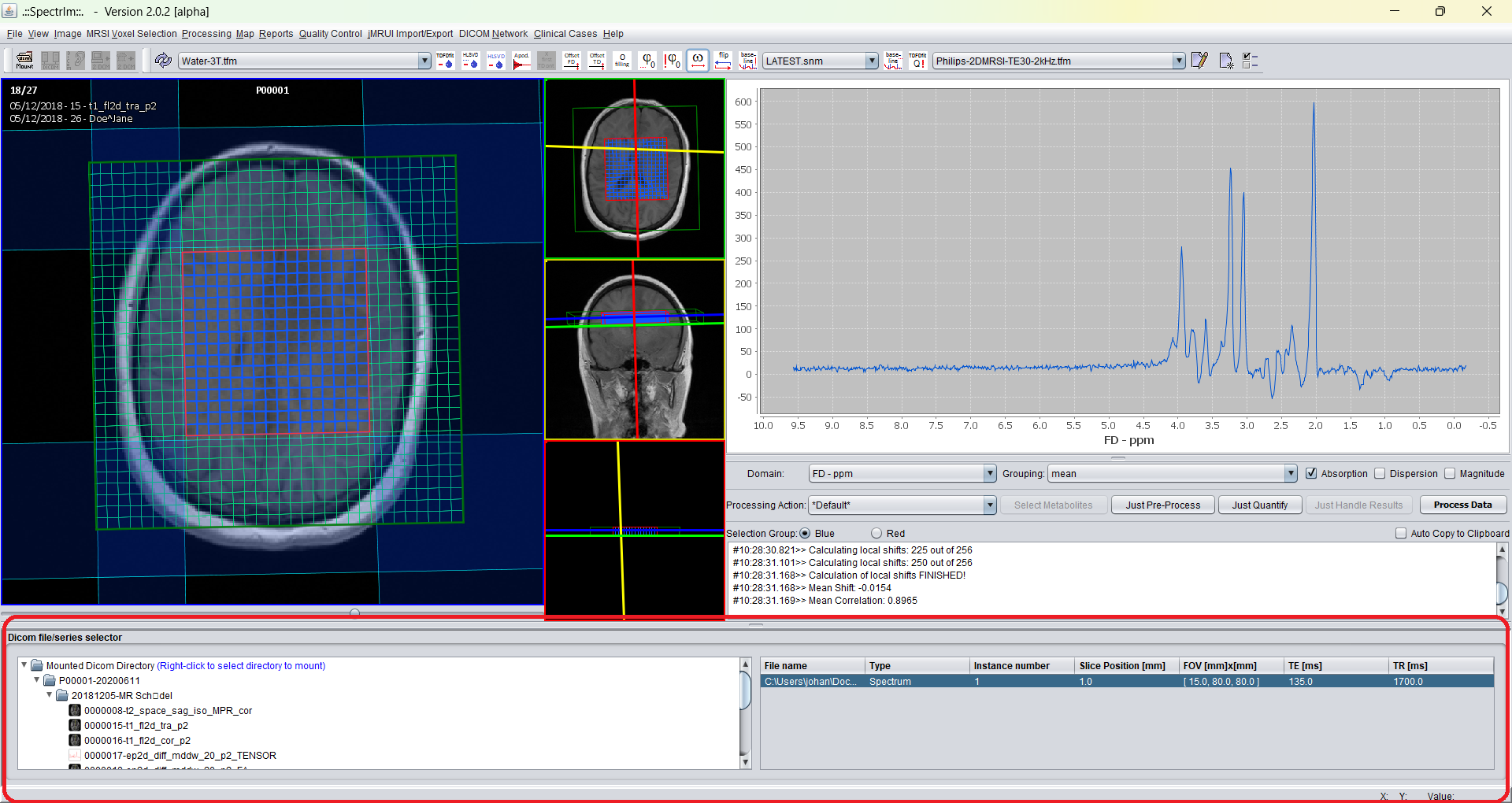 Legacy spectrIm-QMRS Patient Study Browser