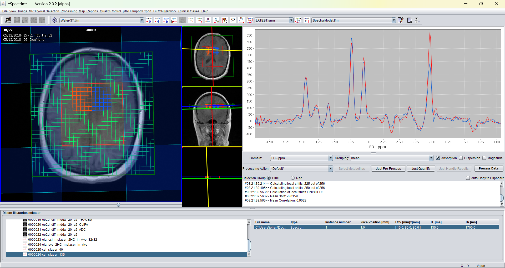 Legacy spectrIm-QMRS simultaneous blue and red spectrum groups
