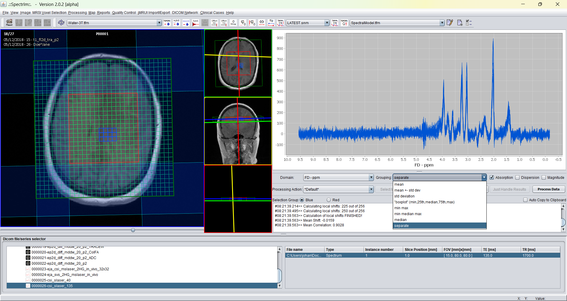 Legacy spectrIm-QMRS supported display modes of main spectrum view