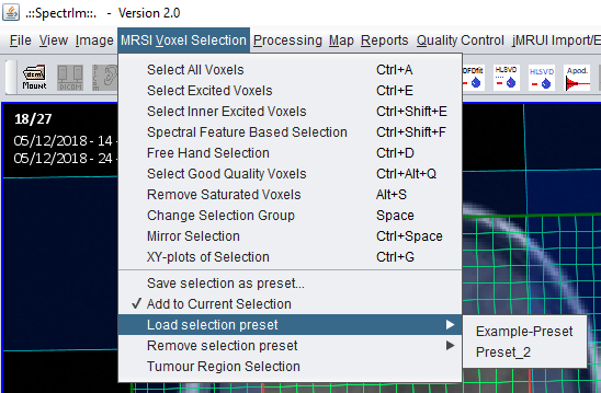 Legacy MRSI selection preset load menu items