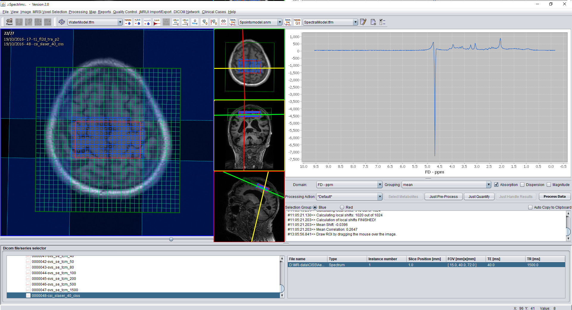 Legacy MRSI selection after saturated voxel removal