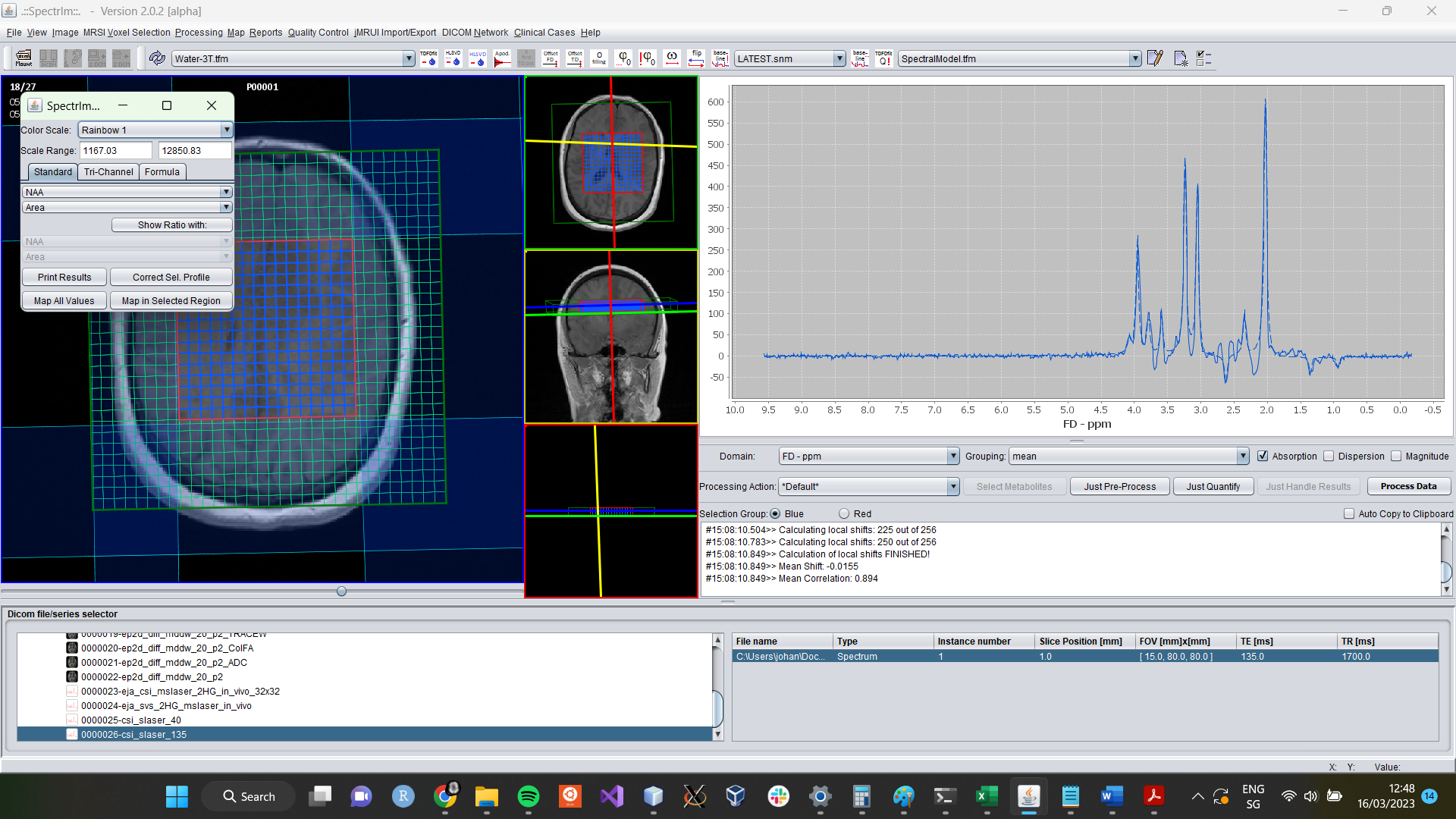 spectrIm-QMRS after TDFDFit fitting has terminated