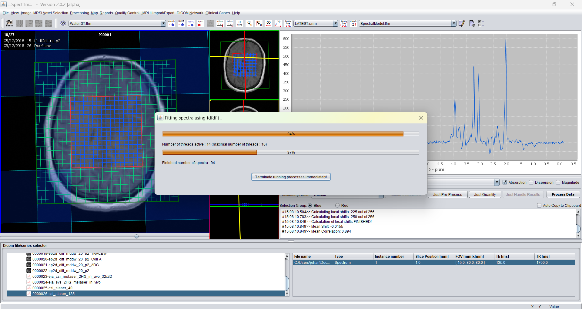 spectrIm-QMRS GUI during the TDFDFit fitting process