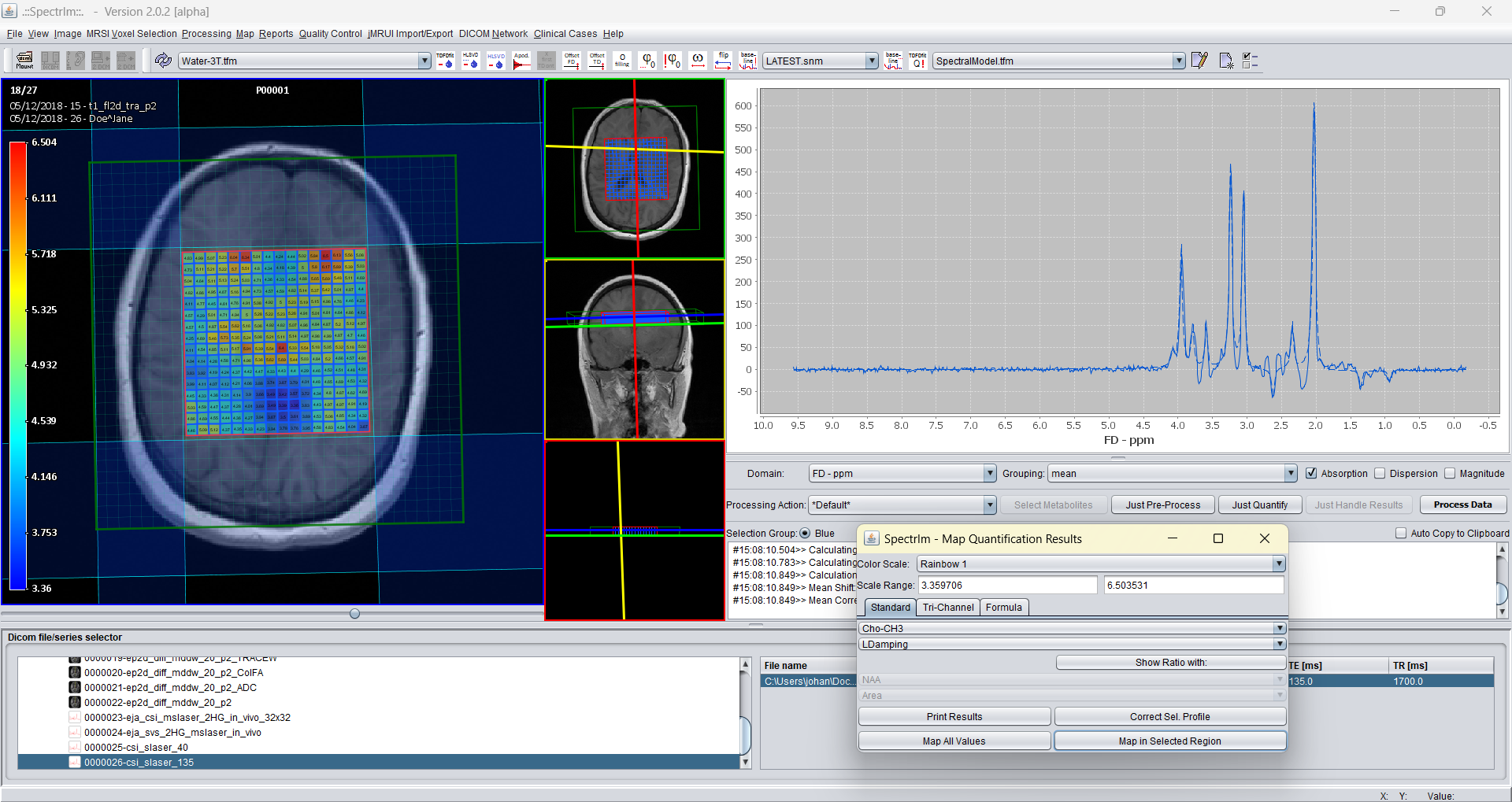 Lorentzian damping parameter map from TDFDFit results