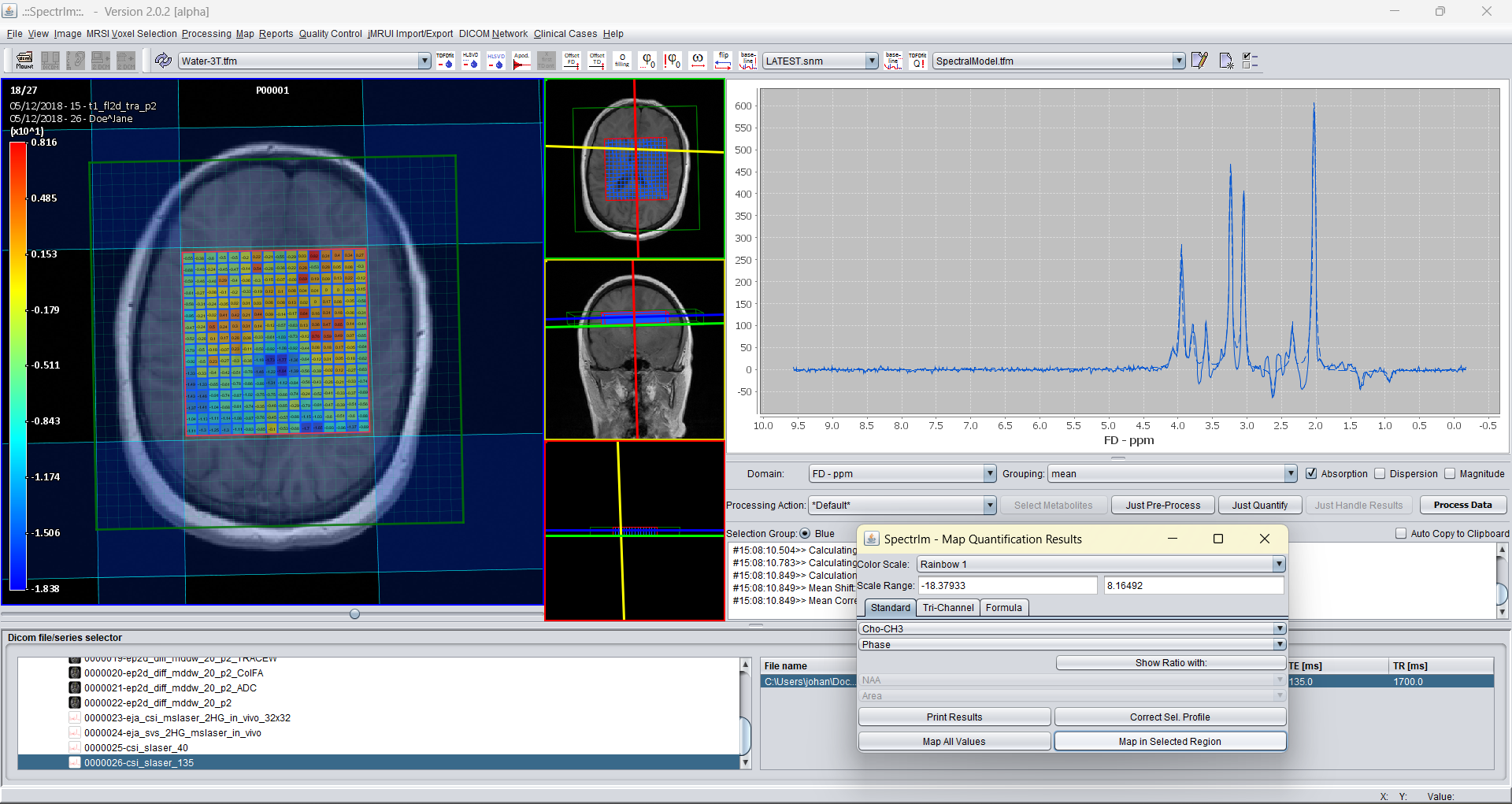 Zero-order phase parameter map from TDFDFit results