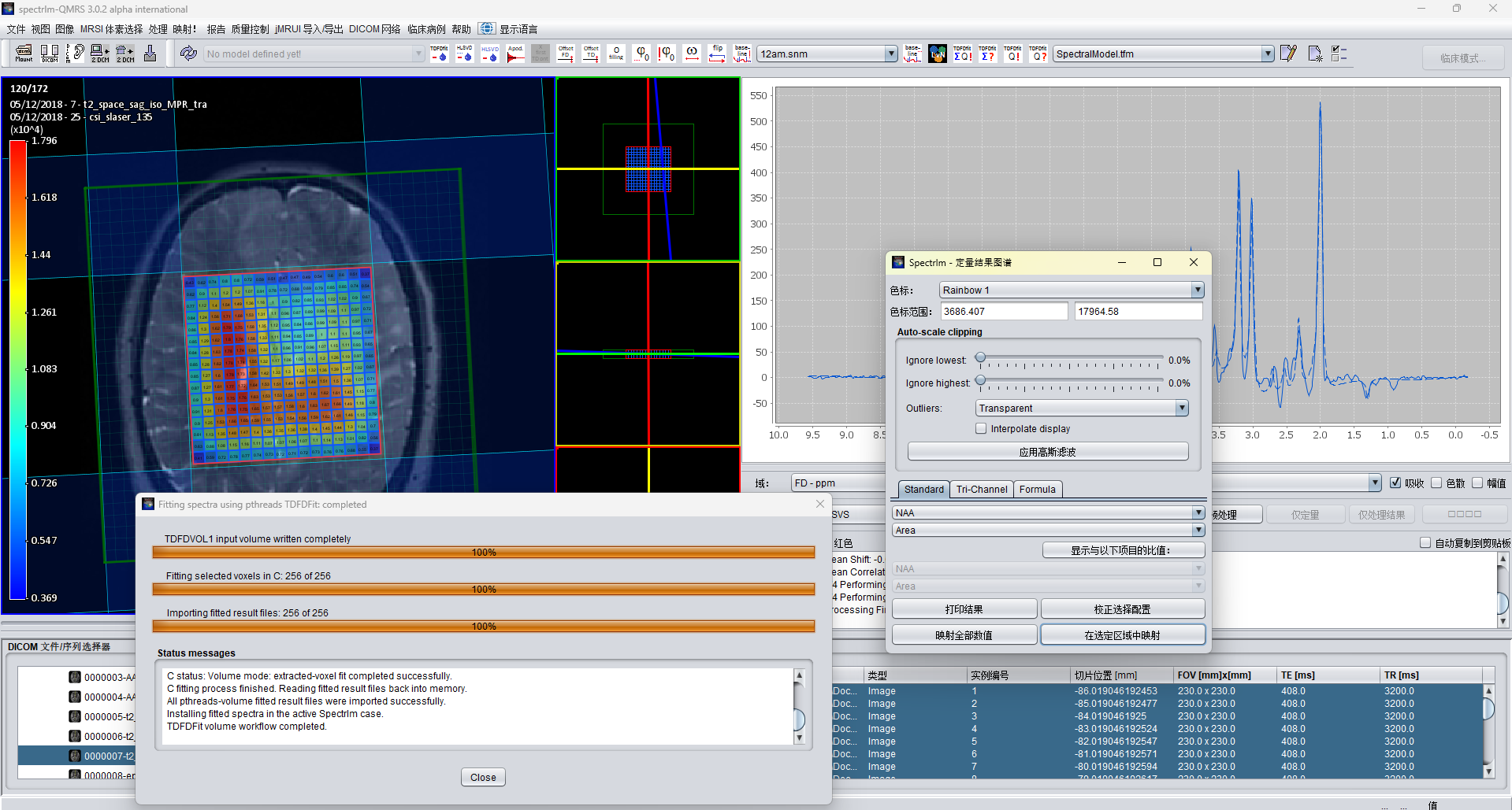 spectrIm-QMRS 3.0.2 Alpha International Clinical Viewer displayed in Simplified Chinese with an MRSI map, spectrum, fitting progress, and quantification controls