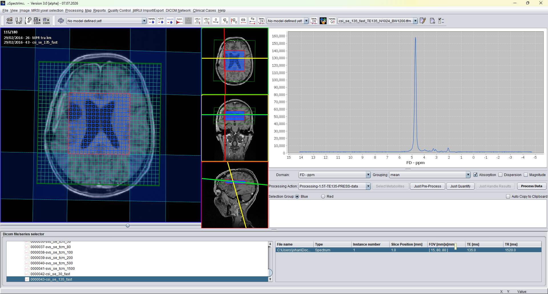 ClinicalViewer showing the Processing Action selector and Process Data button