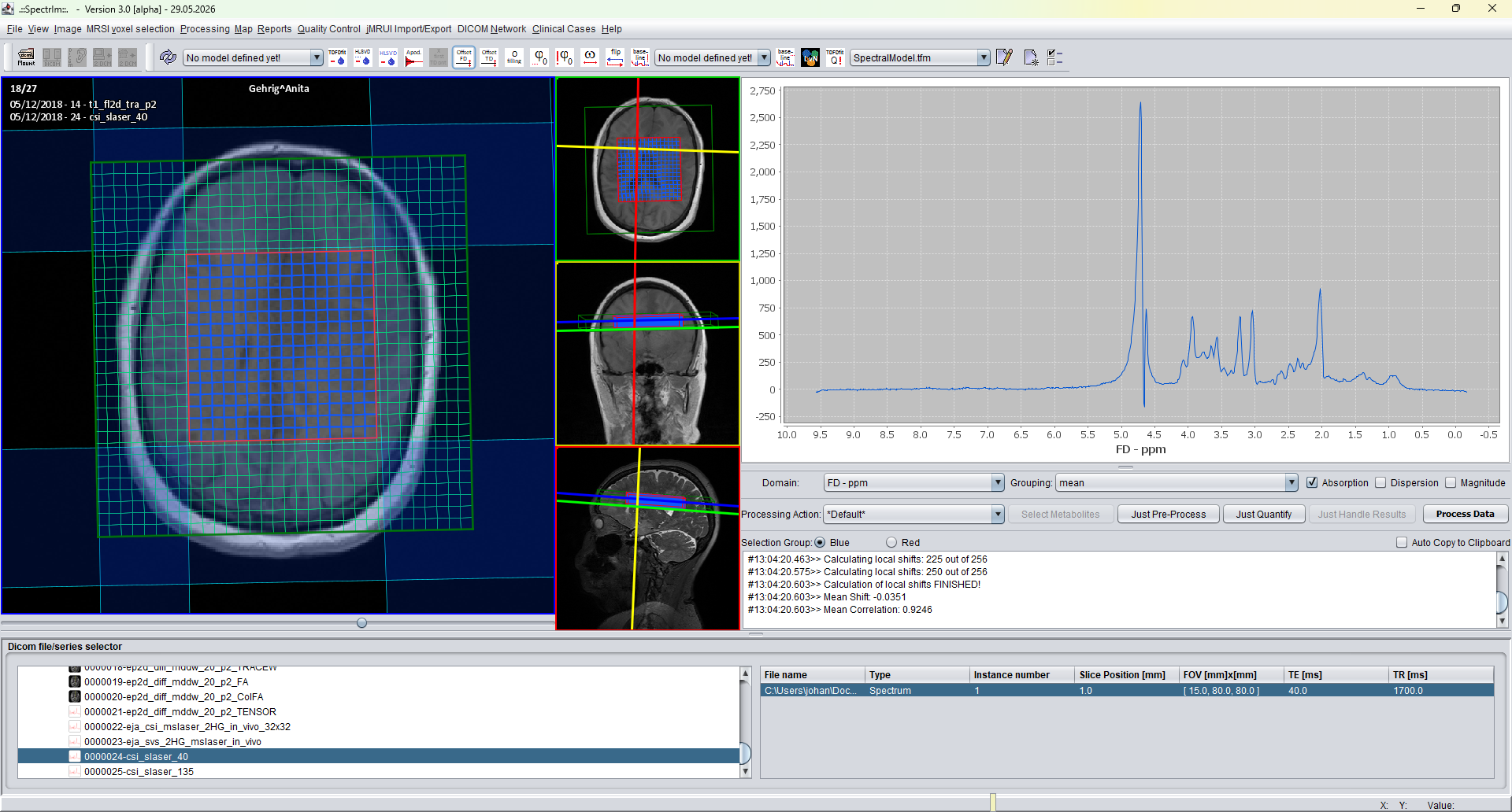 TE 40 ms dataset before HLSVD filtering