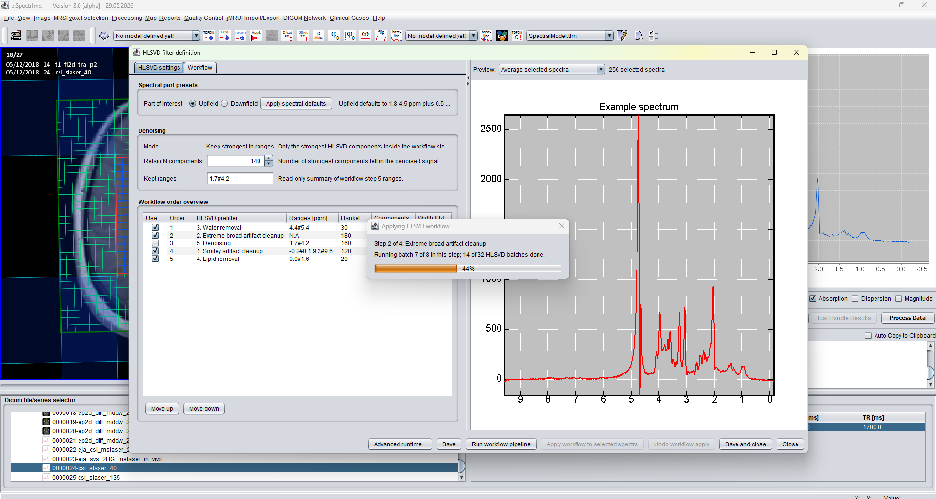 HLSVD workflow progress dialog while processing a TE 40 ms dataset