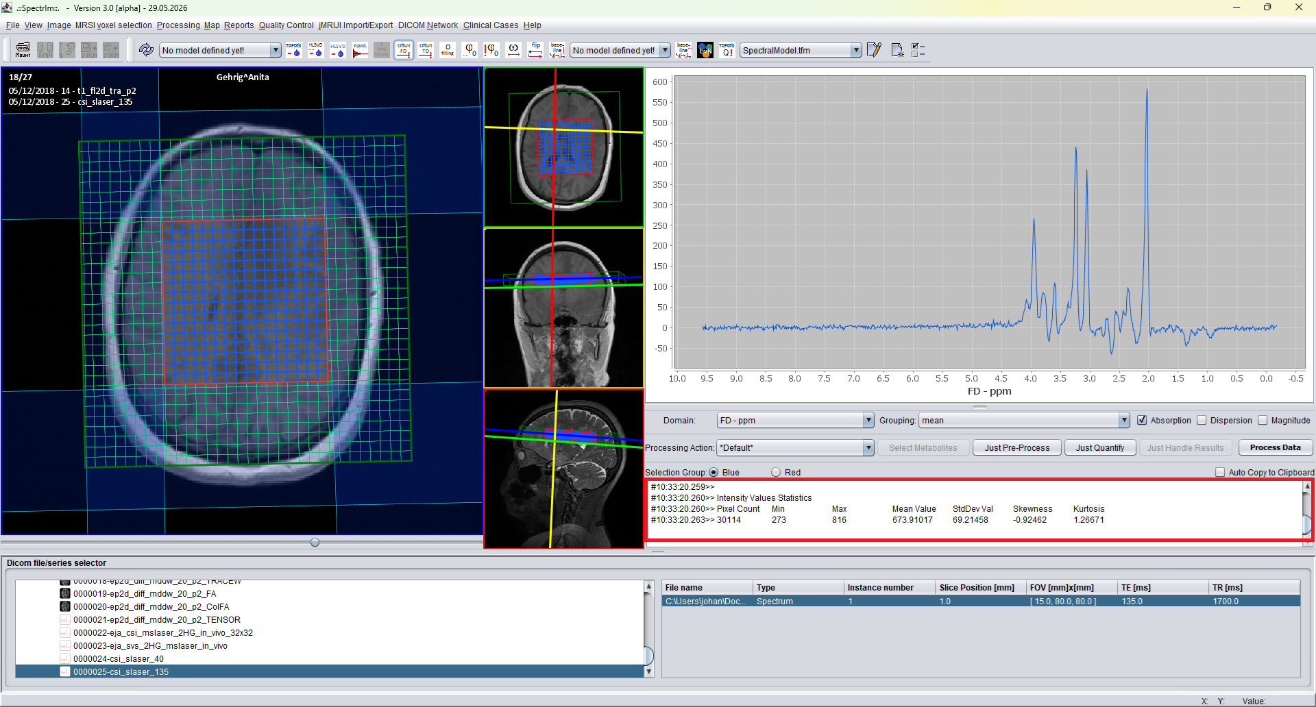 spectrIm-QMRS version 3.0.1 Alpha image statistics output in the red output text area