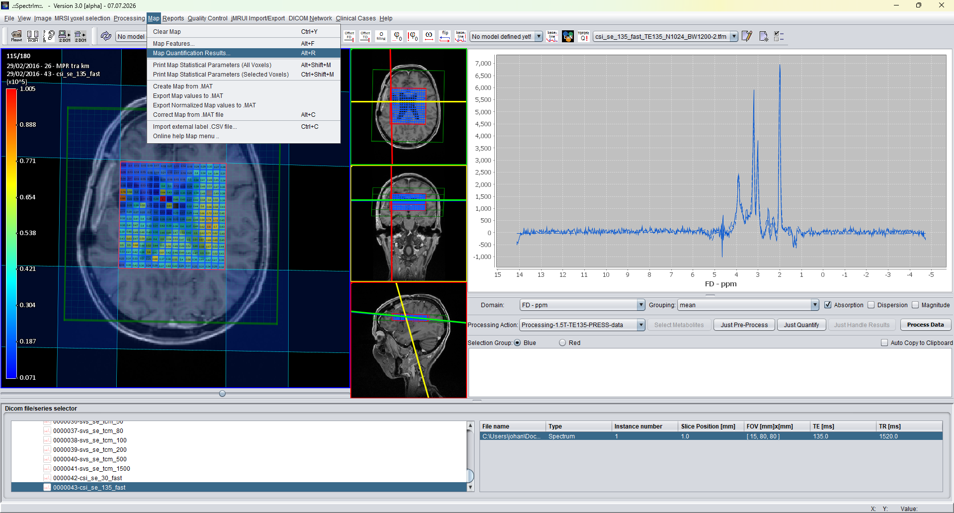 Clinical Viewer Map menu with Map Quantification Results highlighted