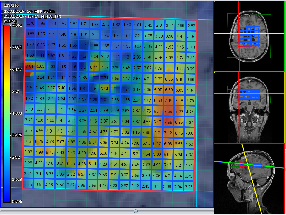 Quantification map displayed with interpolated color overlay
