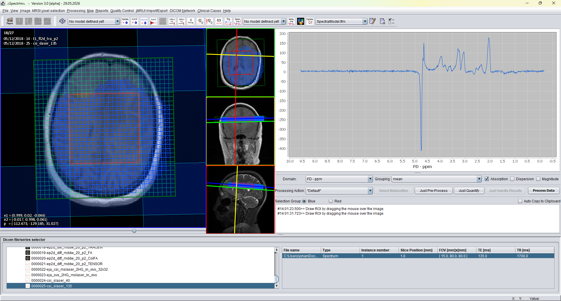 spectrIm-QMRS blue-group MRSI voxel selection before creating XY plots