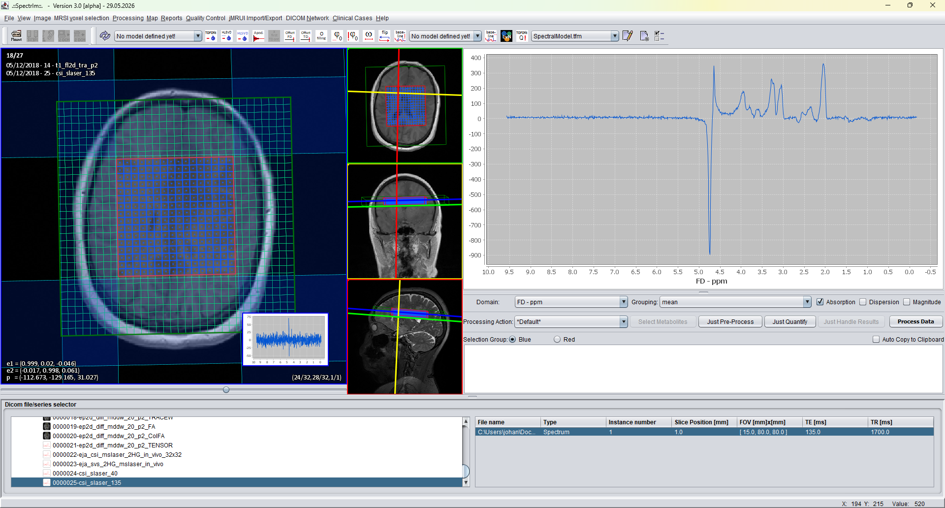 spectrIm-QMRS after selecting excited MRSI voxels with Ctrl+E