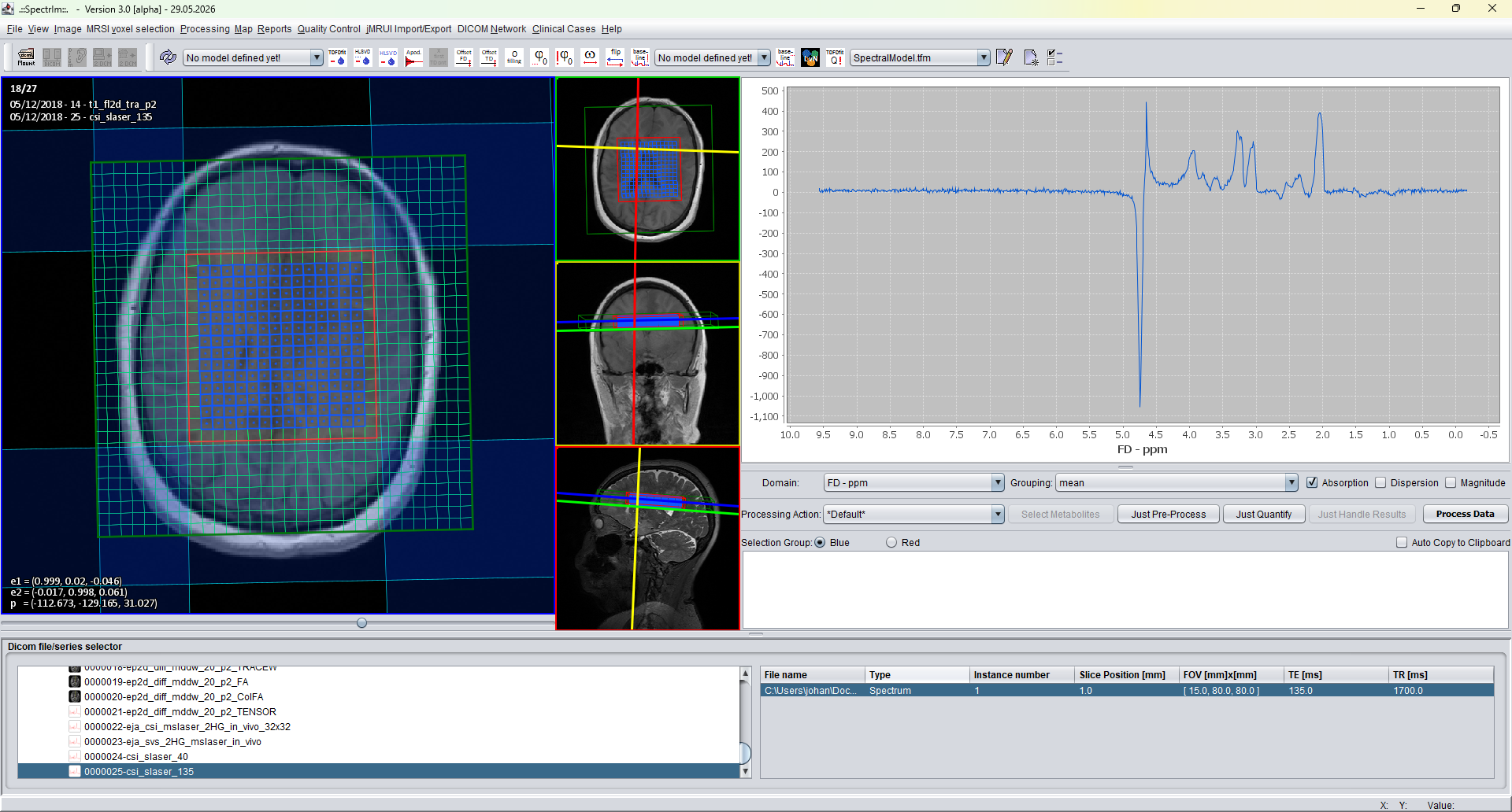 spectrIm-QMRS after selecting inner excited MRSI voxels with Ctrl+Shift+E