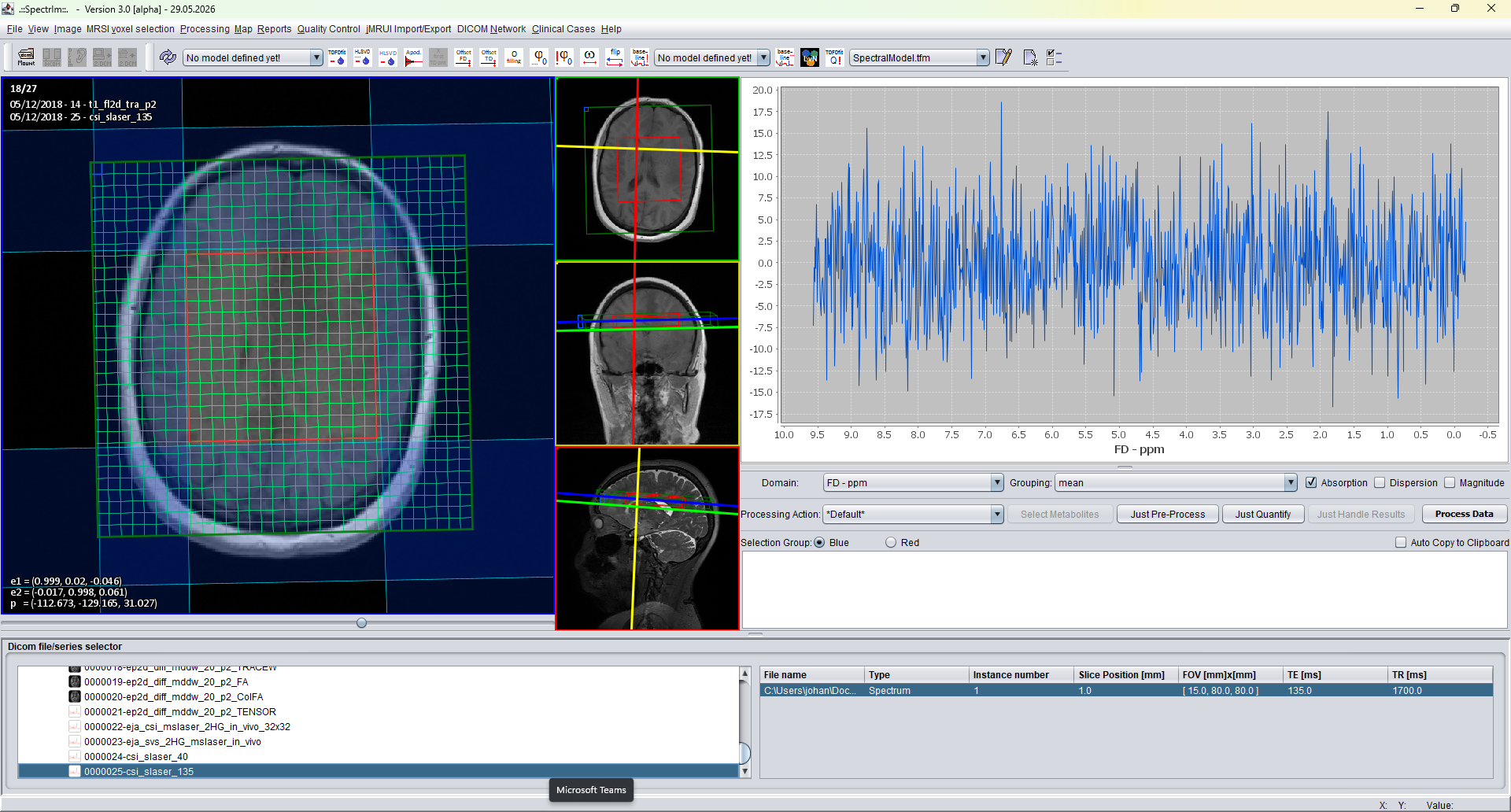 spectrIm-QMRS MRSI dataset loaded before voxel selection