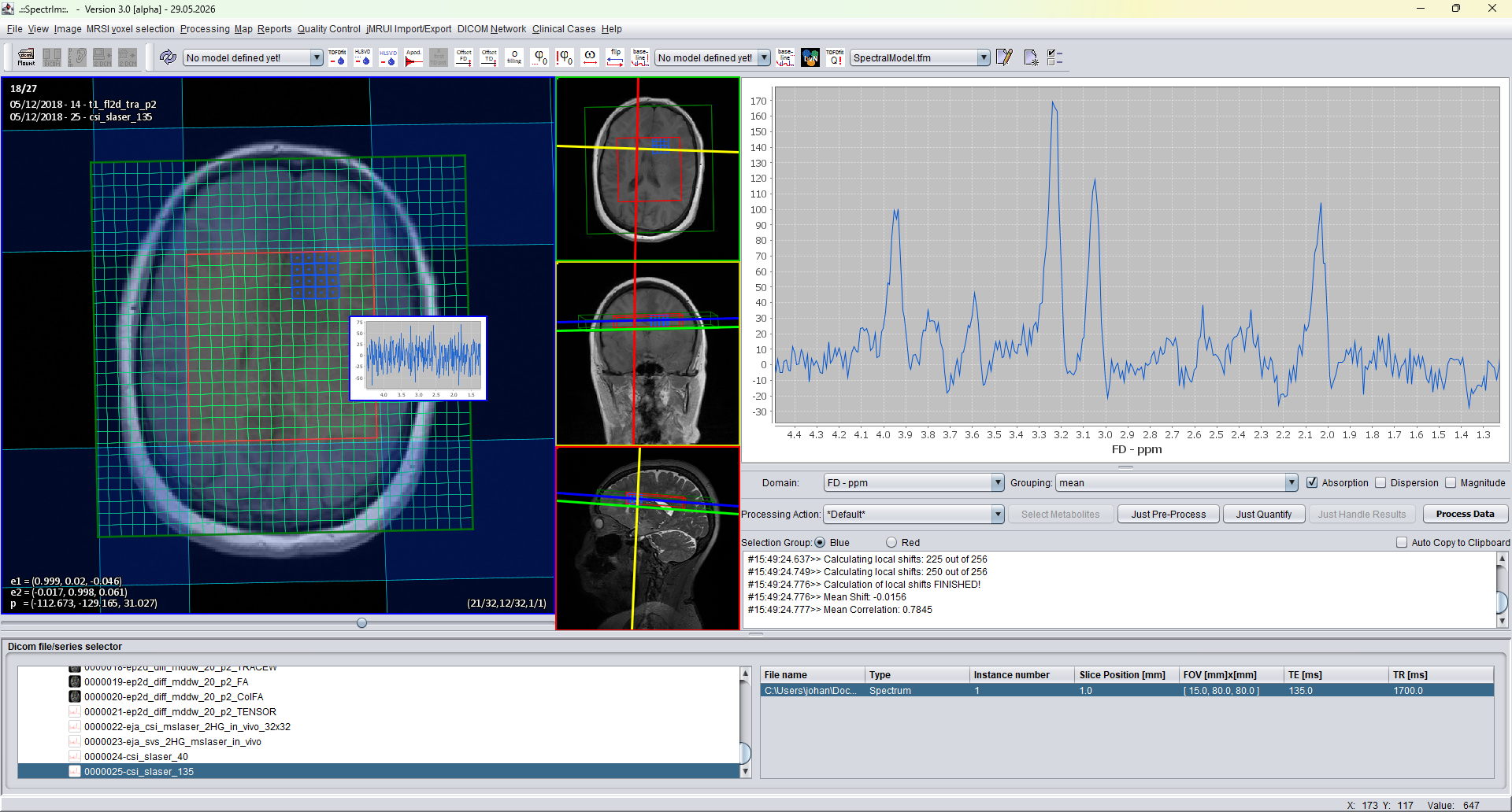 spectrIm-QMRS blue voxel selection before mirror selection