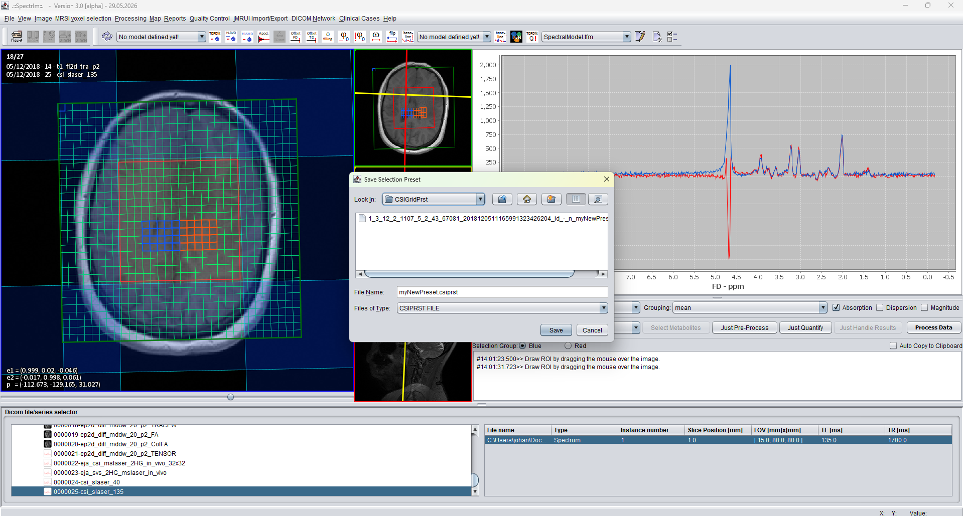 spectrIm-QMRS save selection preset dialog for blue and red voxel groups