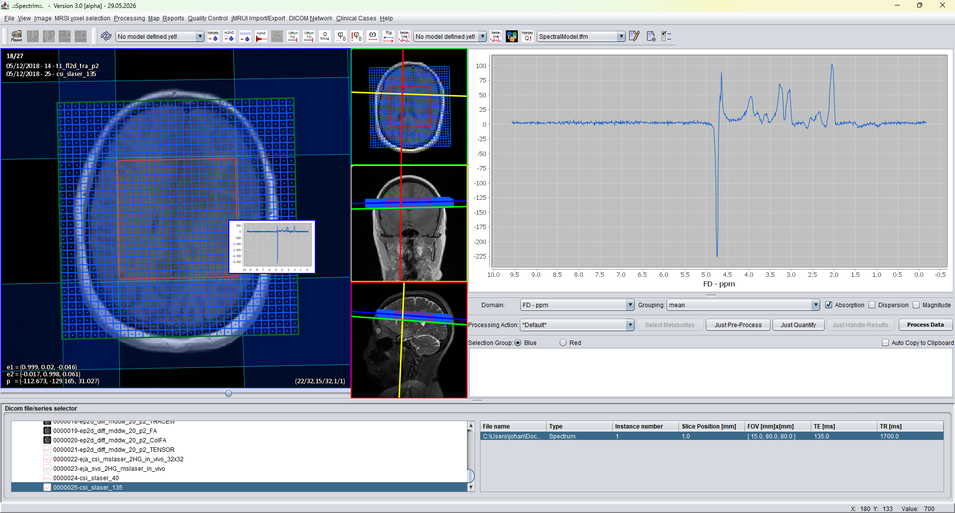spectrIm-QMRS after selecting all MRSI voxels with Ctrl+A