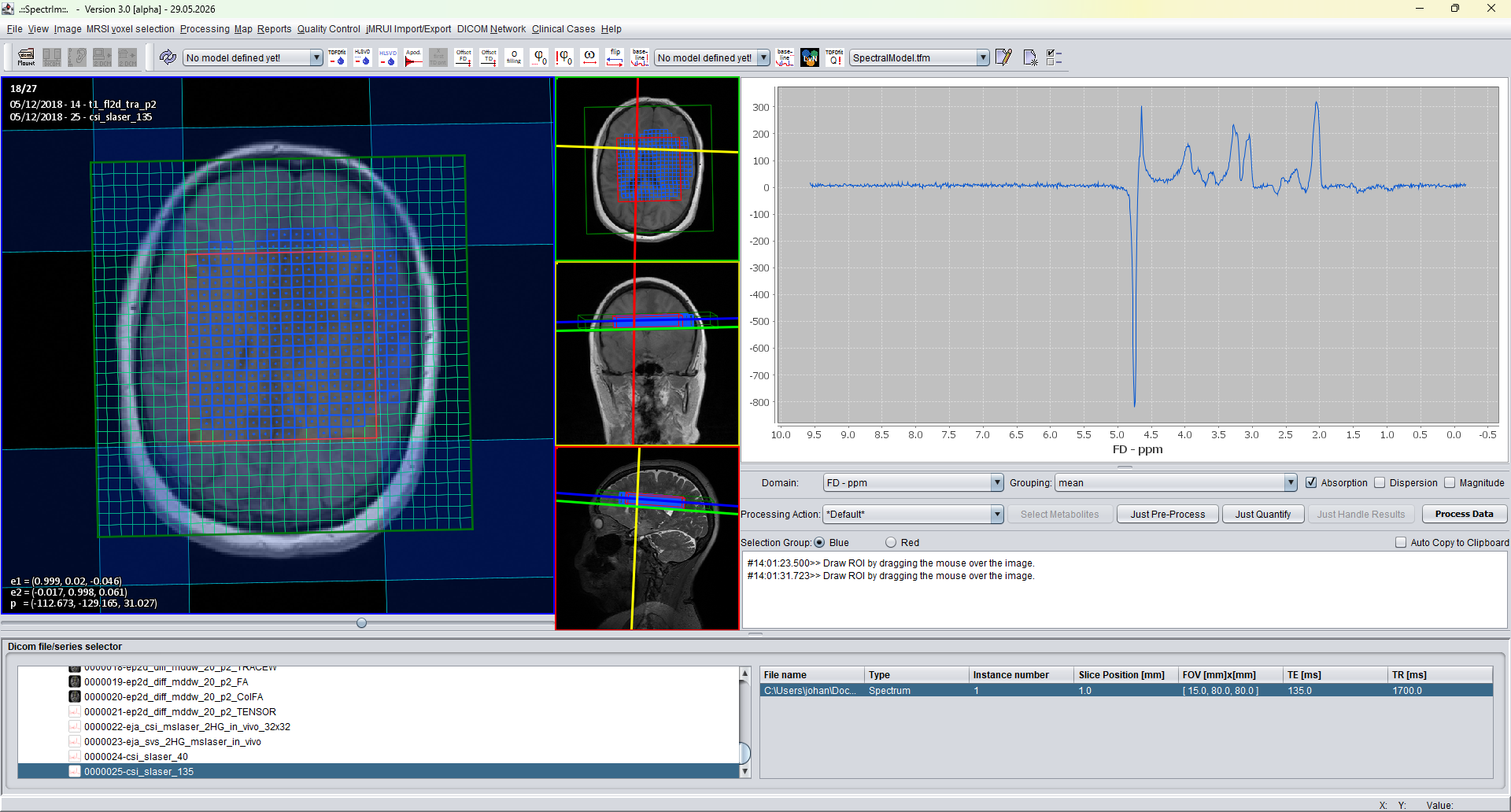 spectrIm-QMRS voxels selected by spectral feature based selection