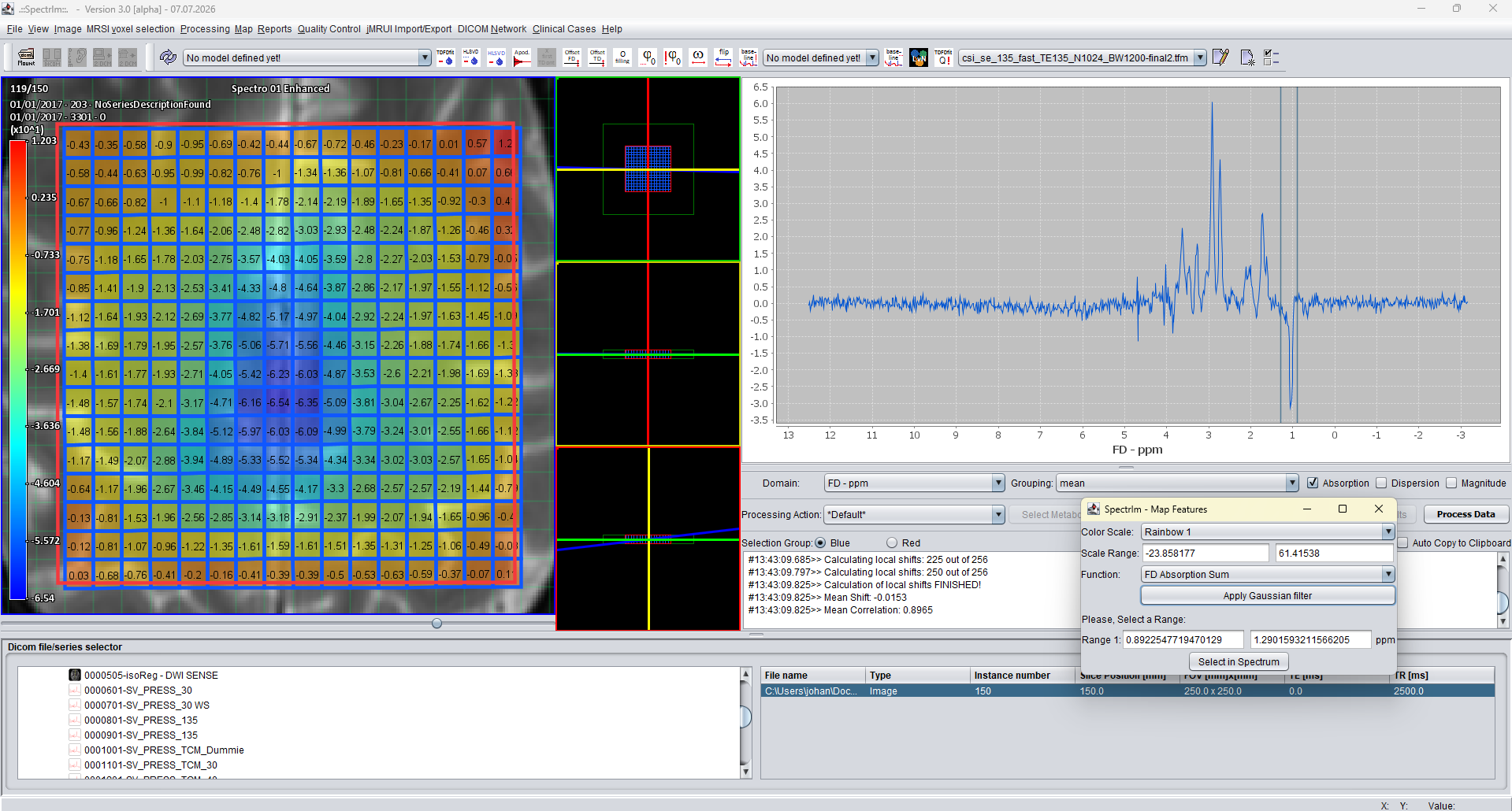 Philips post-mortem enhanced spectroscopy DICOM example loaded in spectrIm-QMRS