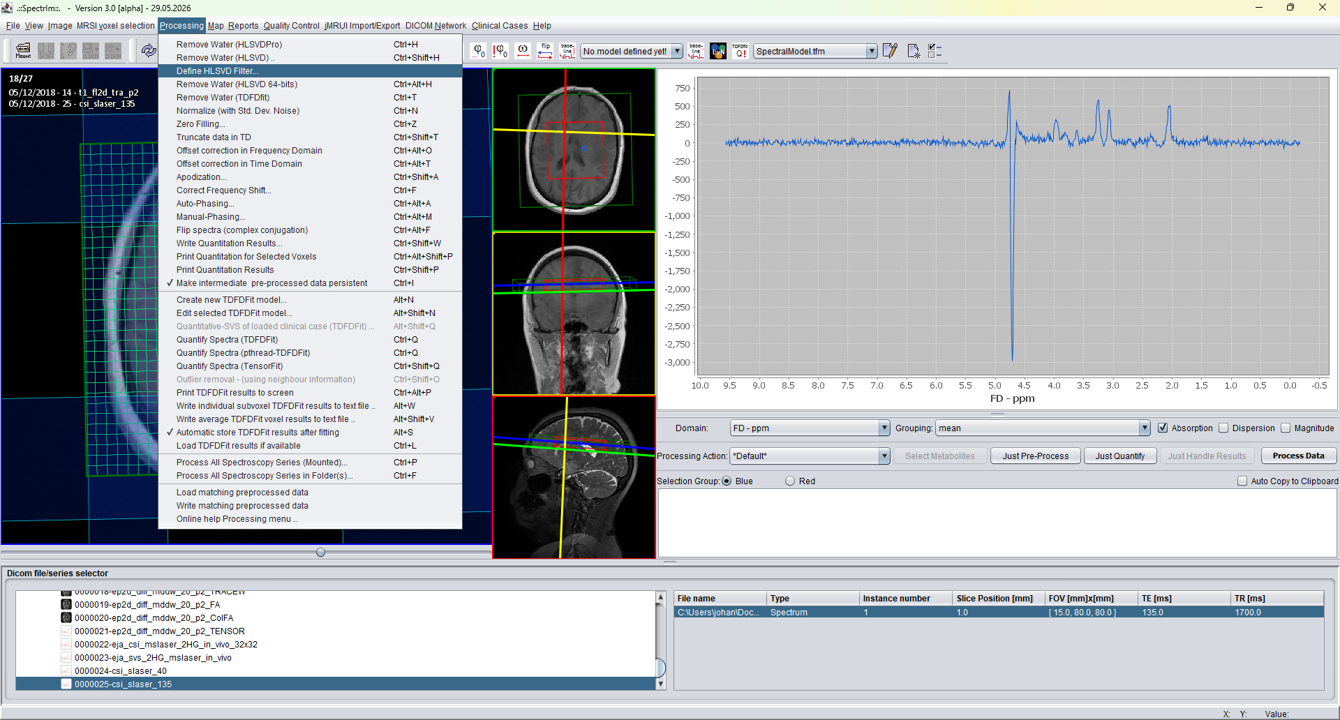 spectrIm-QMRS Processing menu showing Define HLSVD Filter command