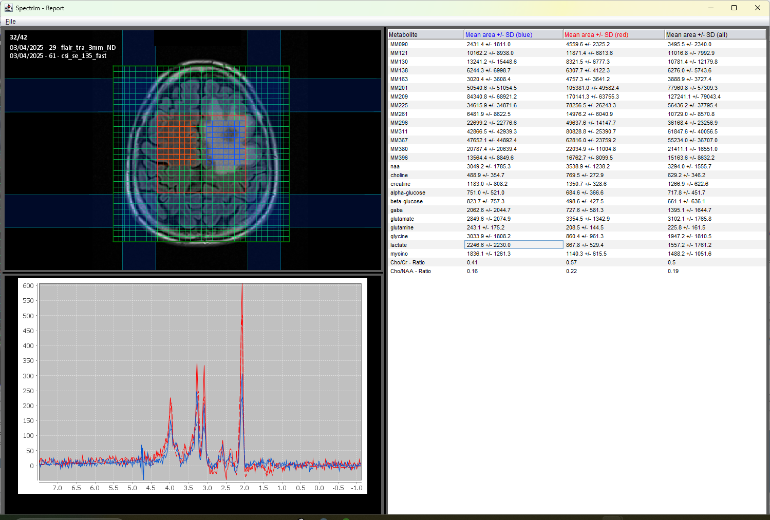 Custom report showing blue and red voxel groups, spectra, and a metabolite area summary table