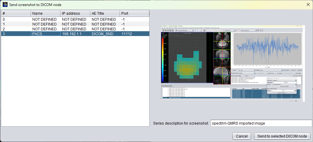 DICOM node selection dialog for sending an imported image Secondary Capture to PACS