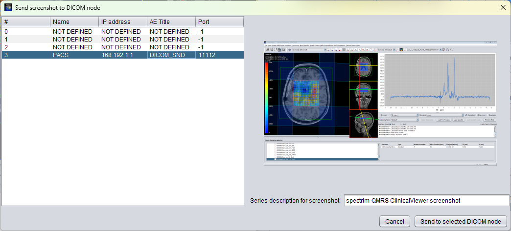 DICOM node selection dialog for sending a Clinical Viewer screenshot Secondary Capture to PACS
