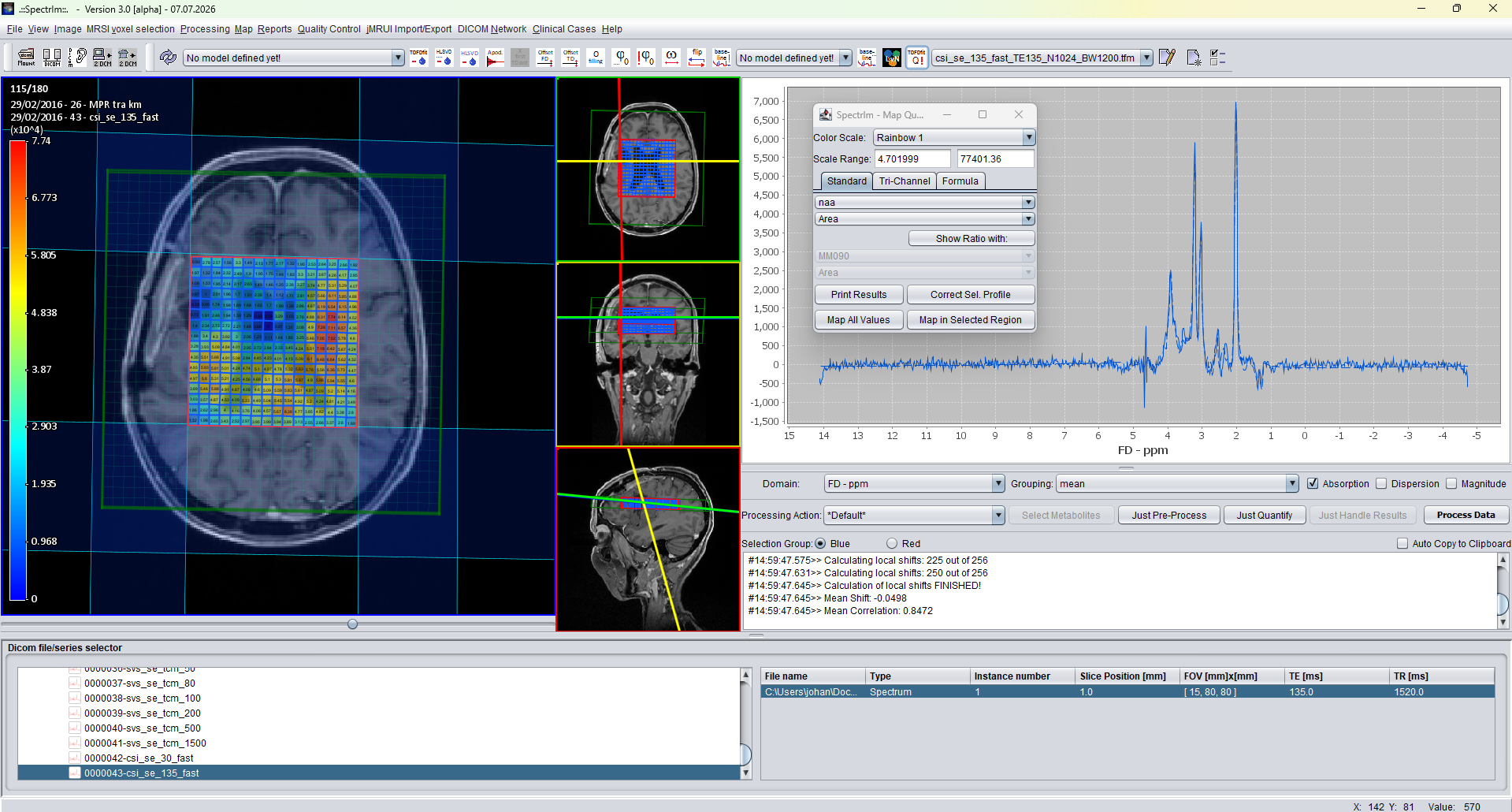Clinical Viewer showing an NAA MRSI result map before using the 2 DCM screenshot toolbar button