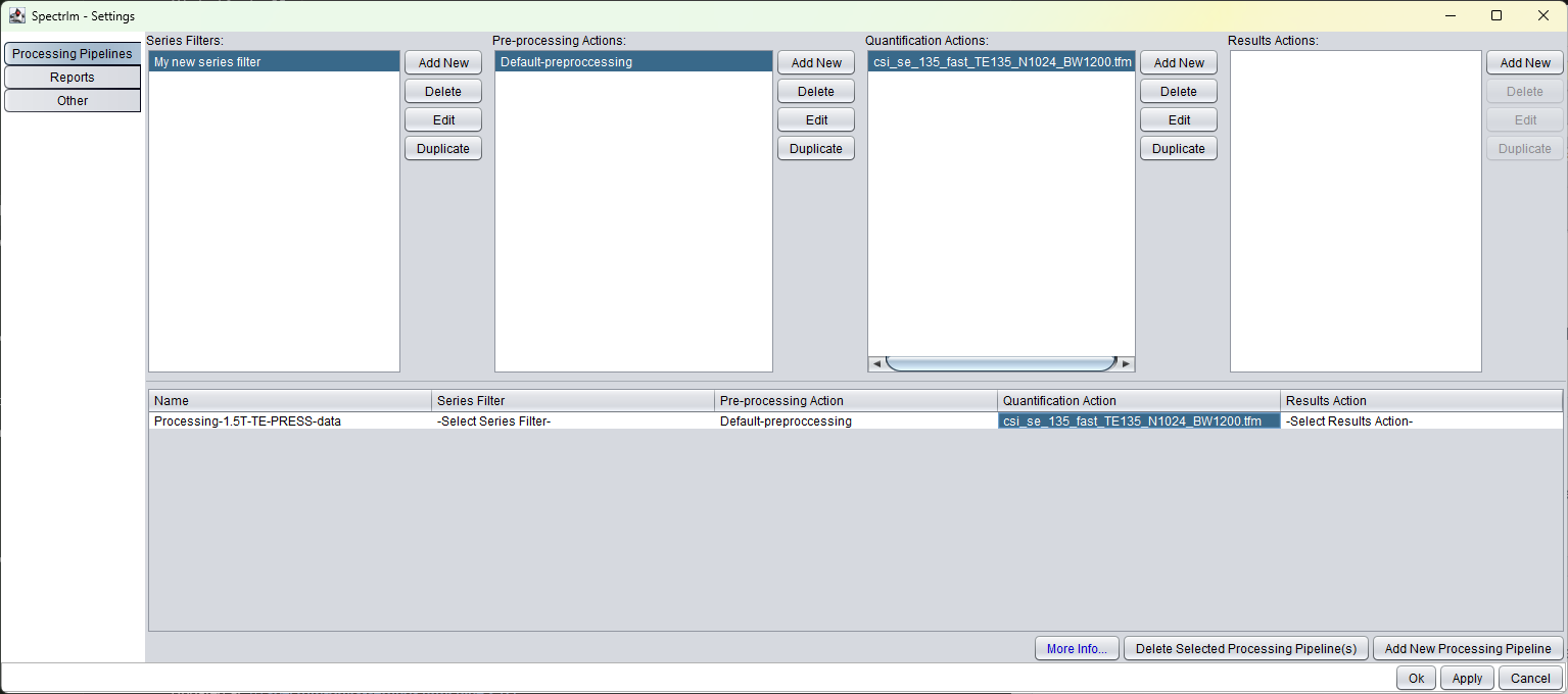 Settings window with a complete processing action composed from preprocessing and quantification actions