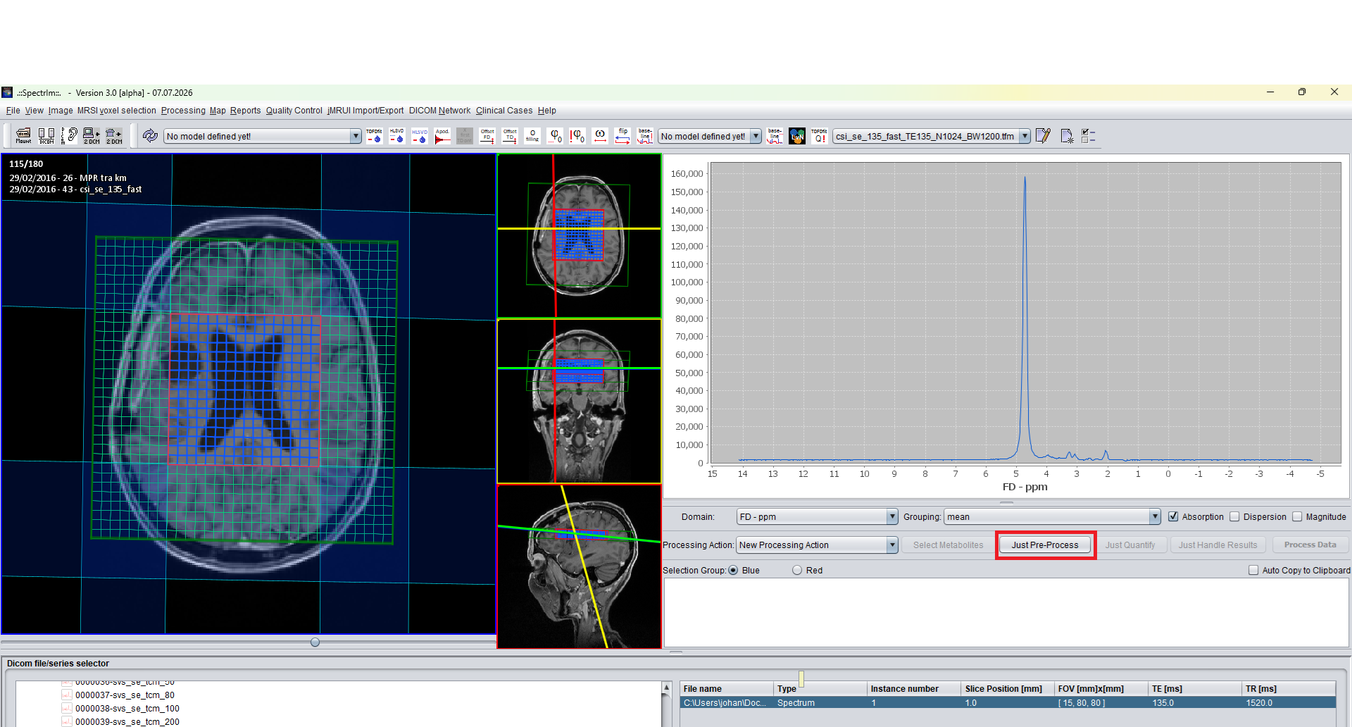 Clinical Viewer with Just Pre-Process button highlighted
