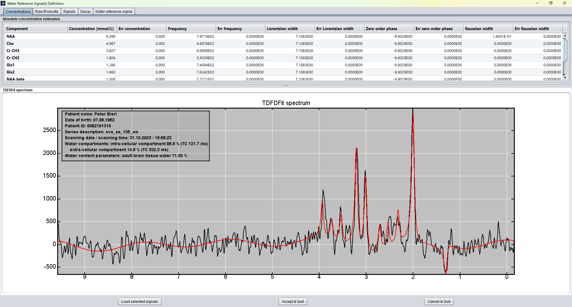 Clinical SVS quantification window showing concentration estimates and TDFDFit spectrum overlay