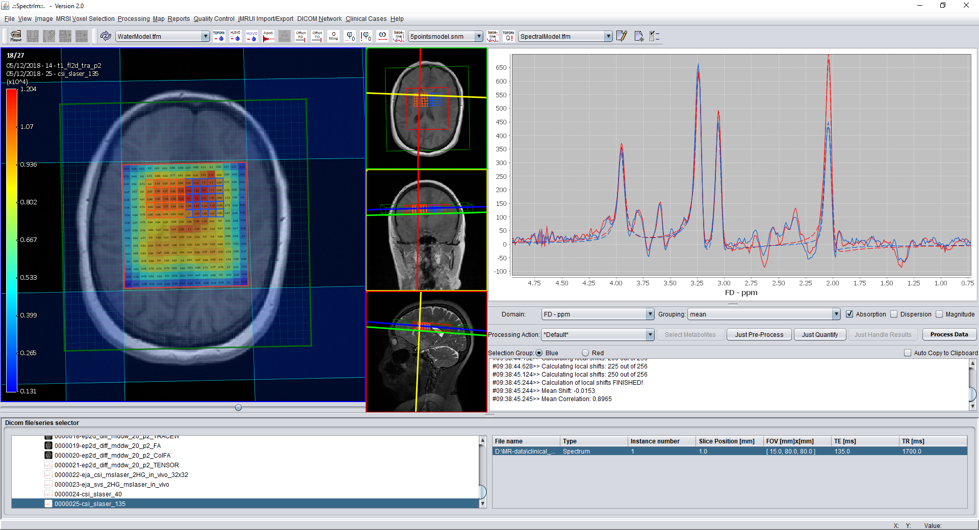 spectrIm-QMRS displaying a processed 2D-MRSI dataset