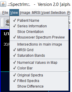 spectrIm-QMRS displaying the View menu