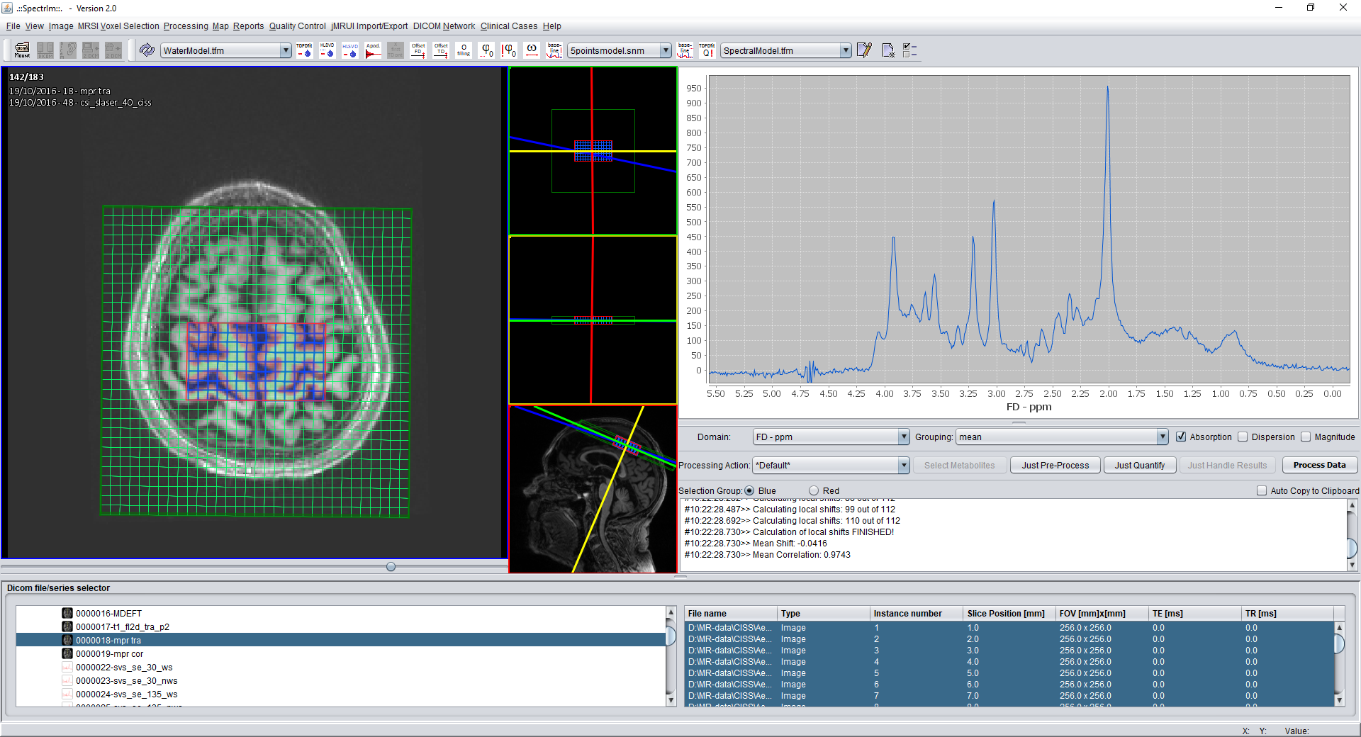 Using spectrIm-QMRS to segment MRI images withing the selected MRSI volumes.