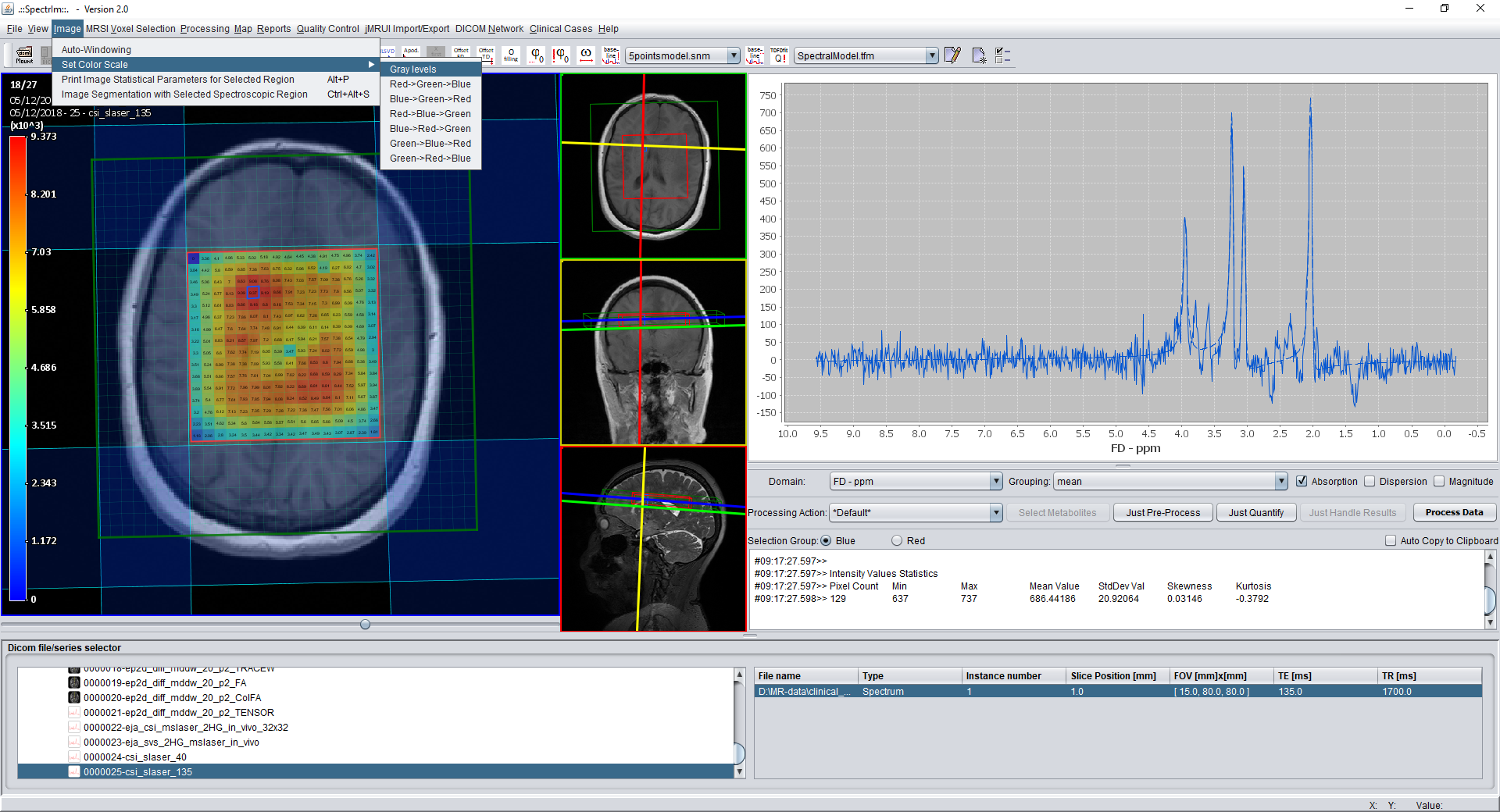 spectrIm-QMRS displaying the image menu