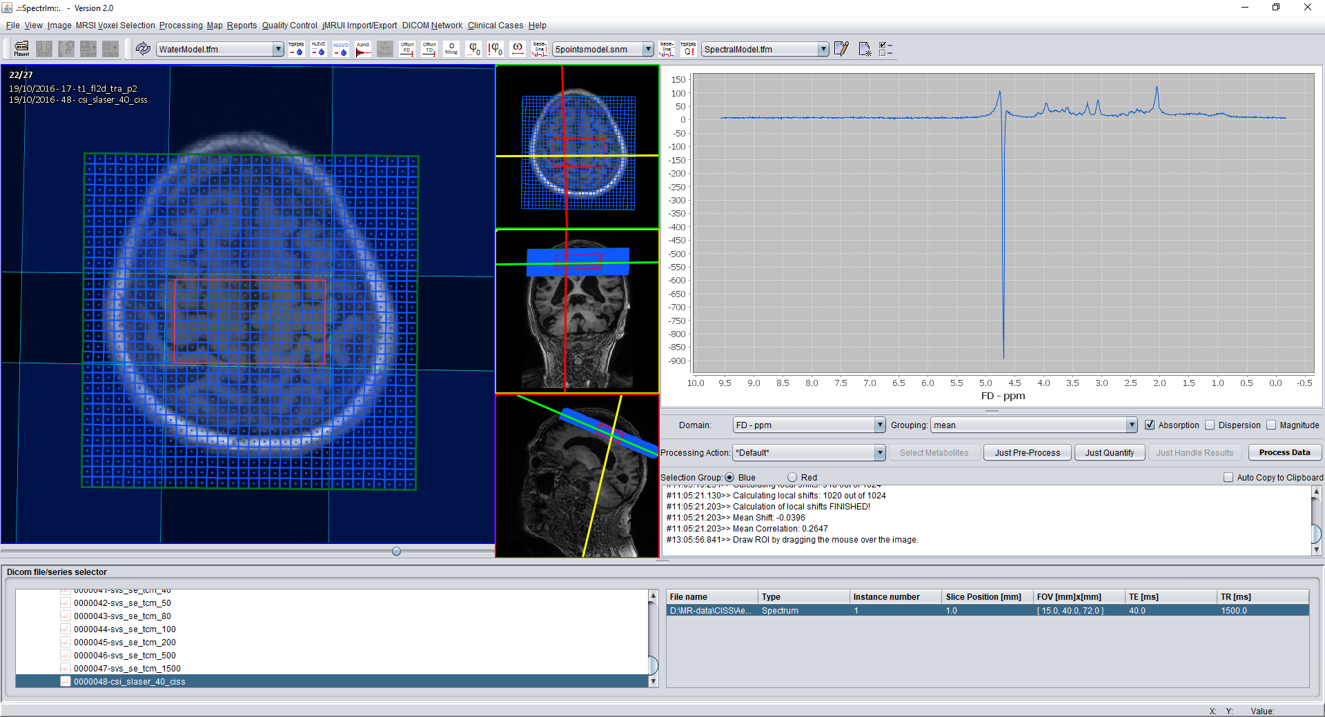 Selecting only the spectroscopic voxels that are within the excited volume and outside the saturated volume.