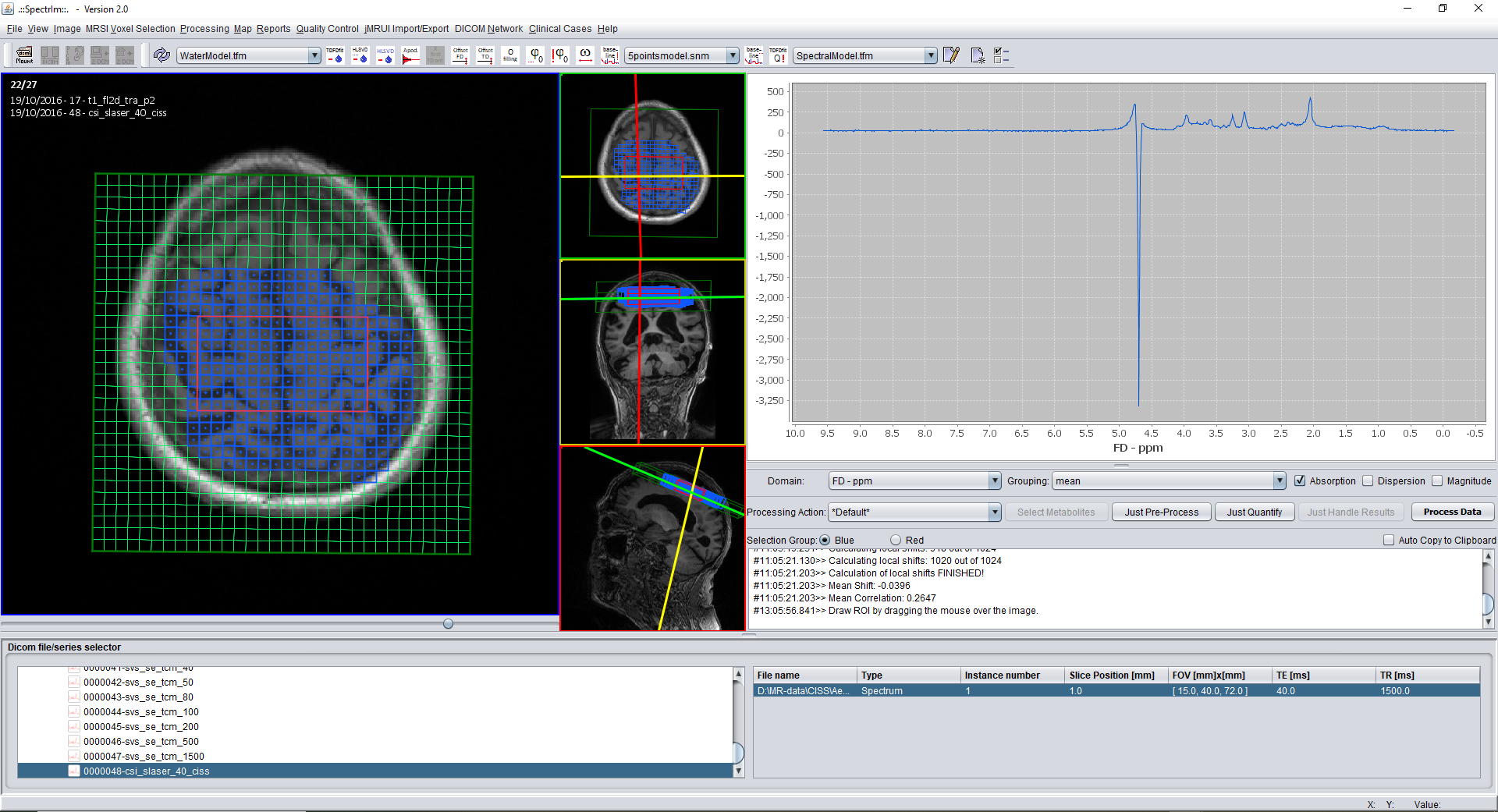 Selecting only those spectroscopic voxels which within a freehand contour drawn by the user.