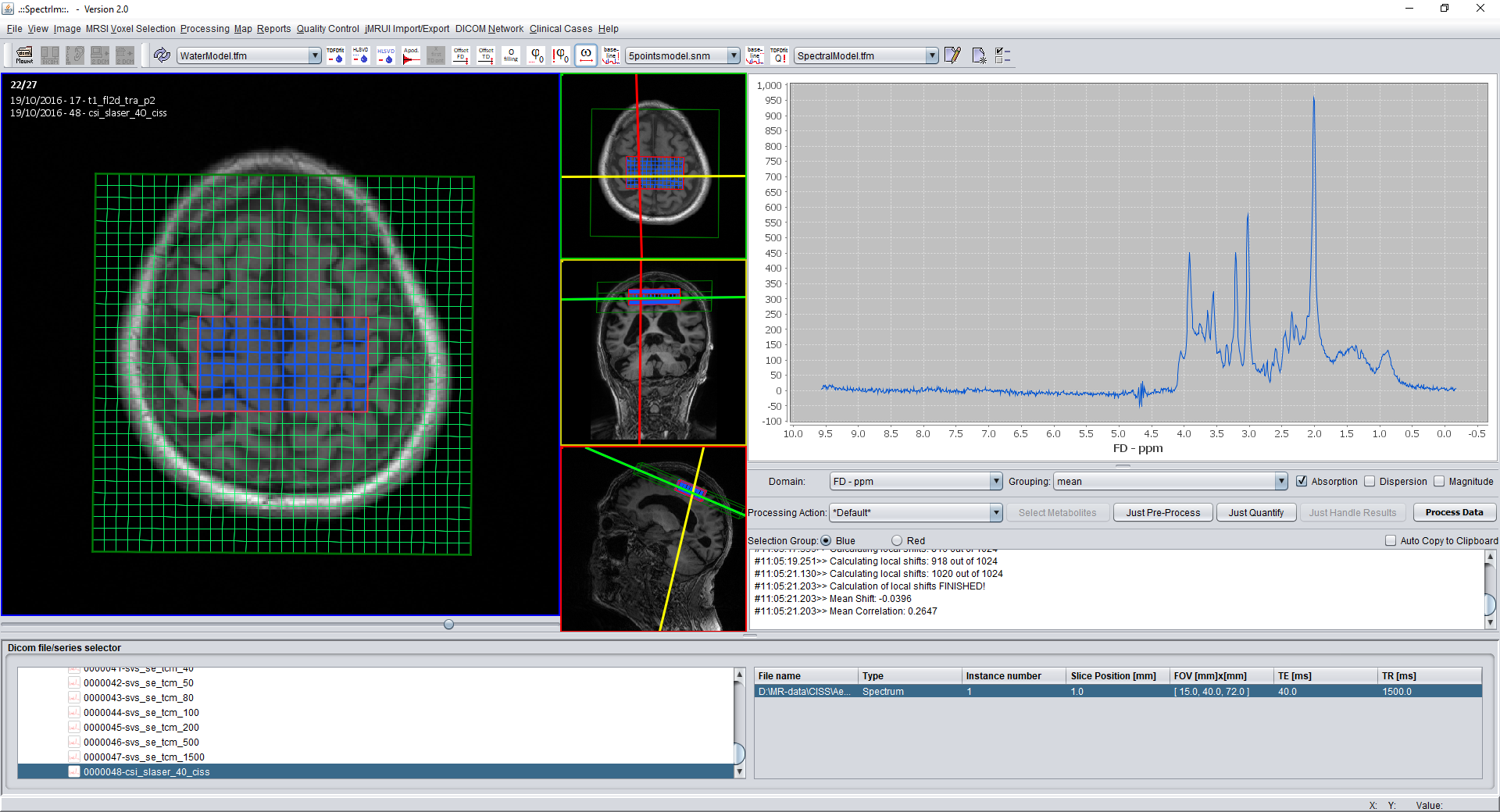 Selecting only those spectroscopic voxels of a 2D MRSI-data set which where excited by RF pulses.