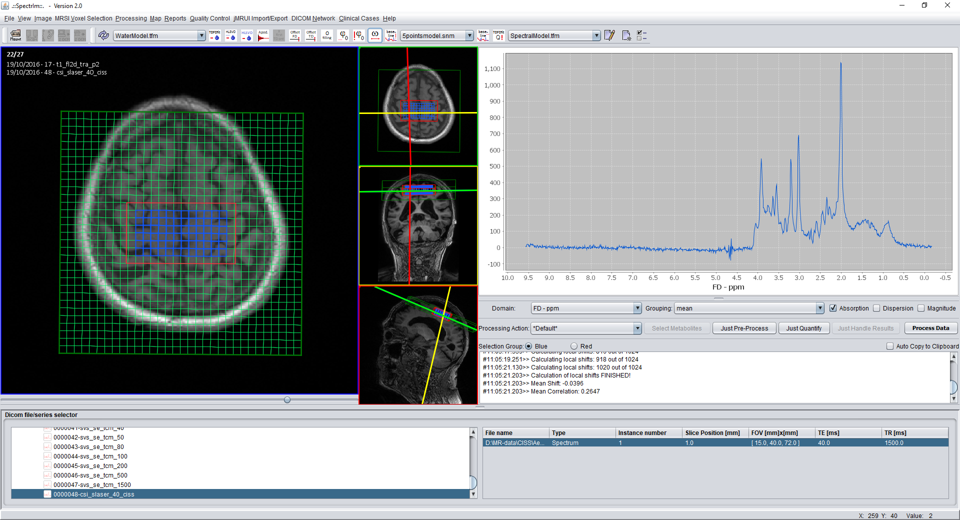 Selecting only the inner spectroscopic voxels of a 2D MRSI-data set which where excited by RF pulses.