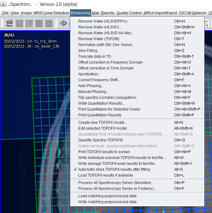 spectrIm-QMRS processing menu image