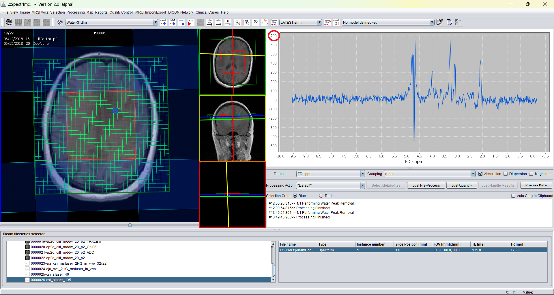 Graphical user interface without noise normalization selected.