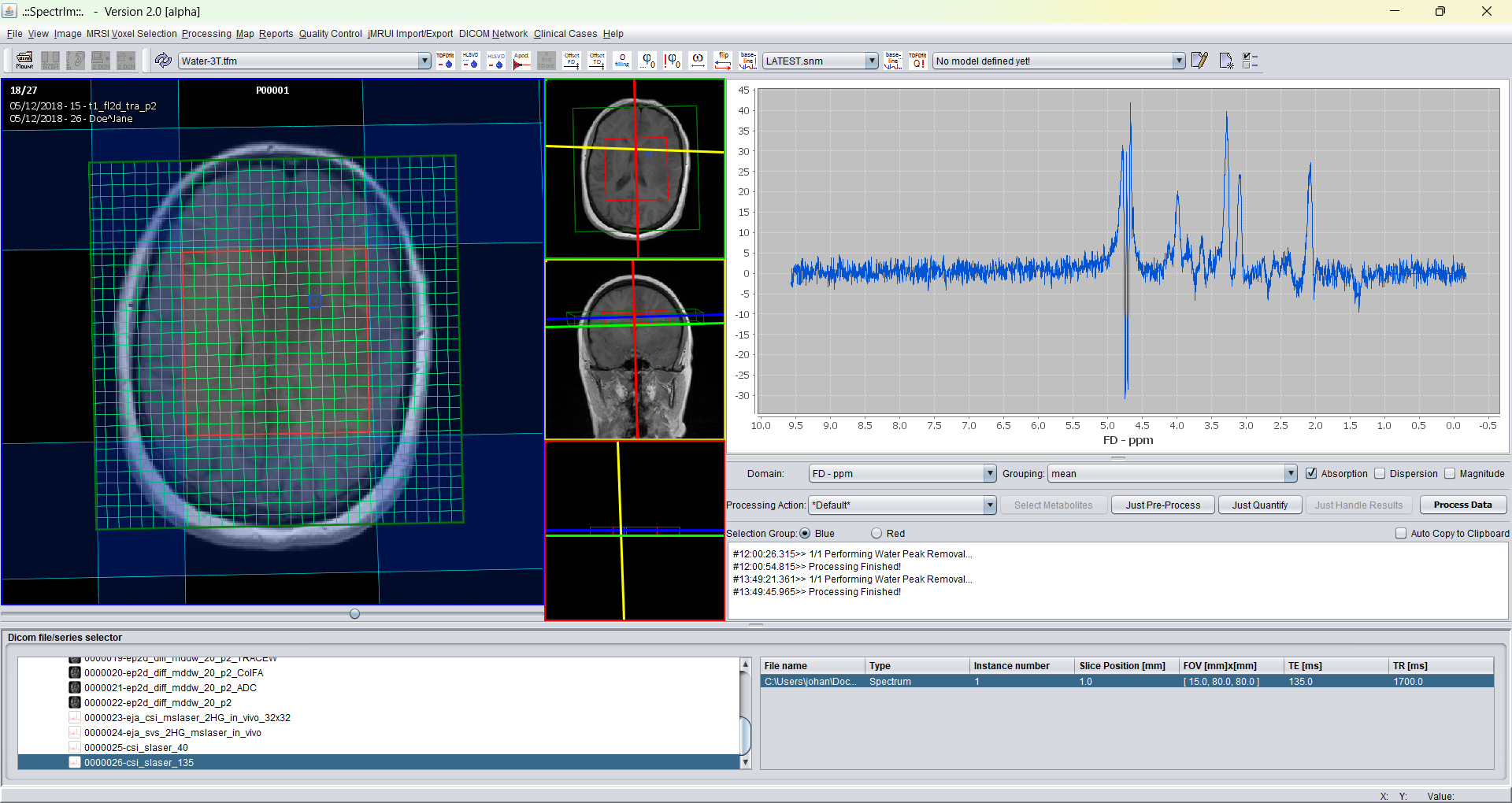 Graphical user interface effect of a eight fold zero filling factor.