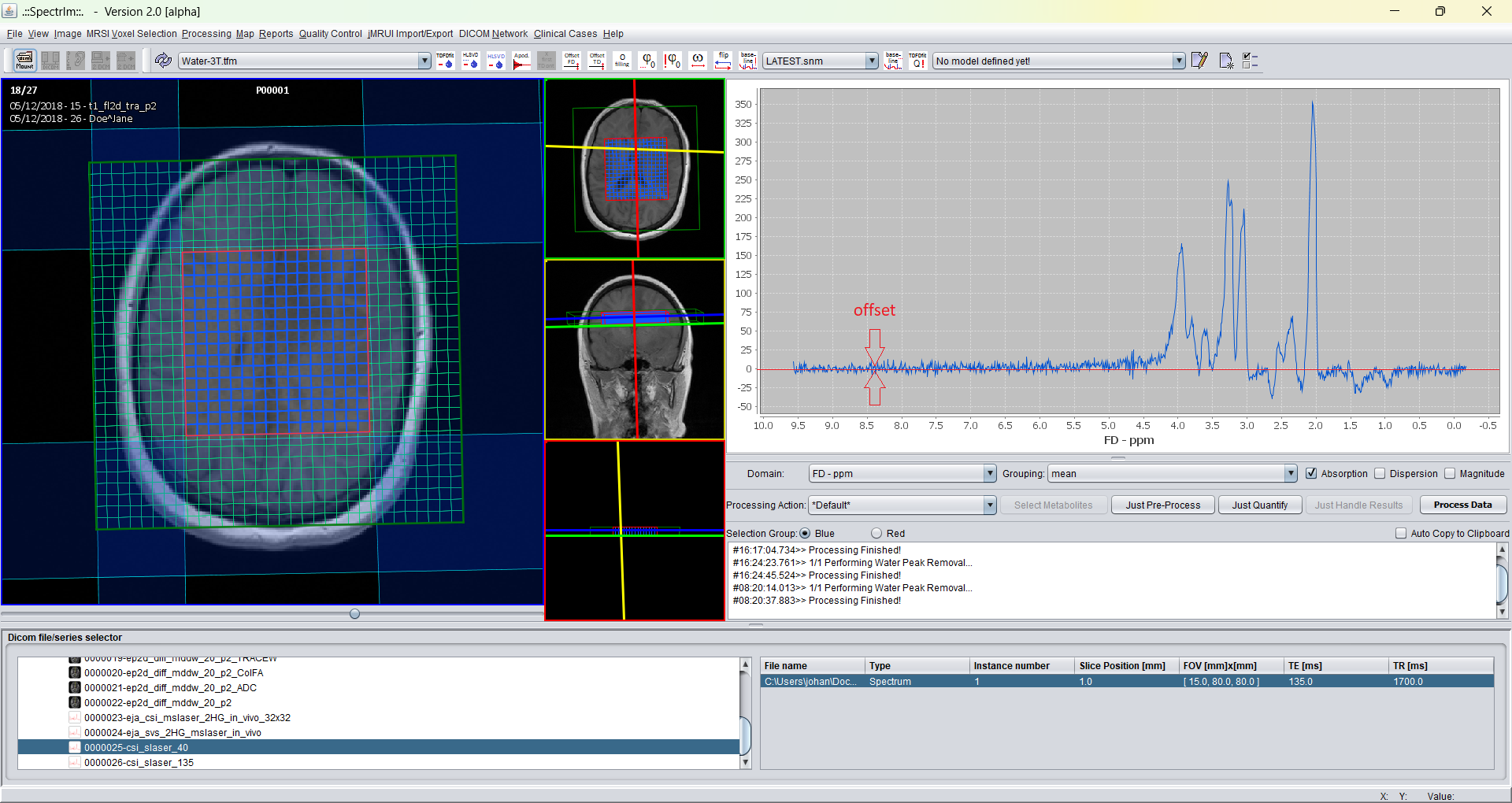 Graphical user interface after application of frequency domain offset removal.