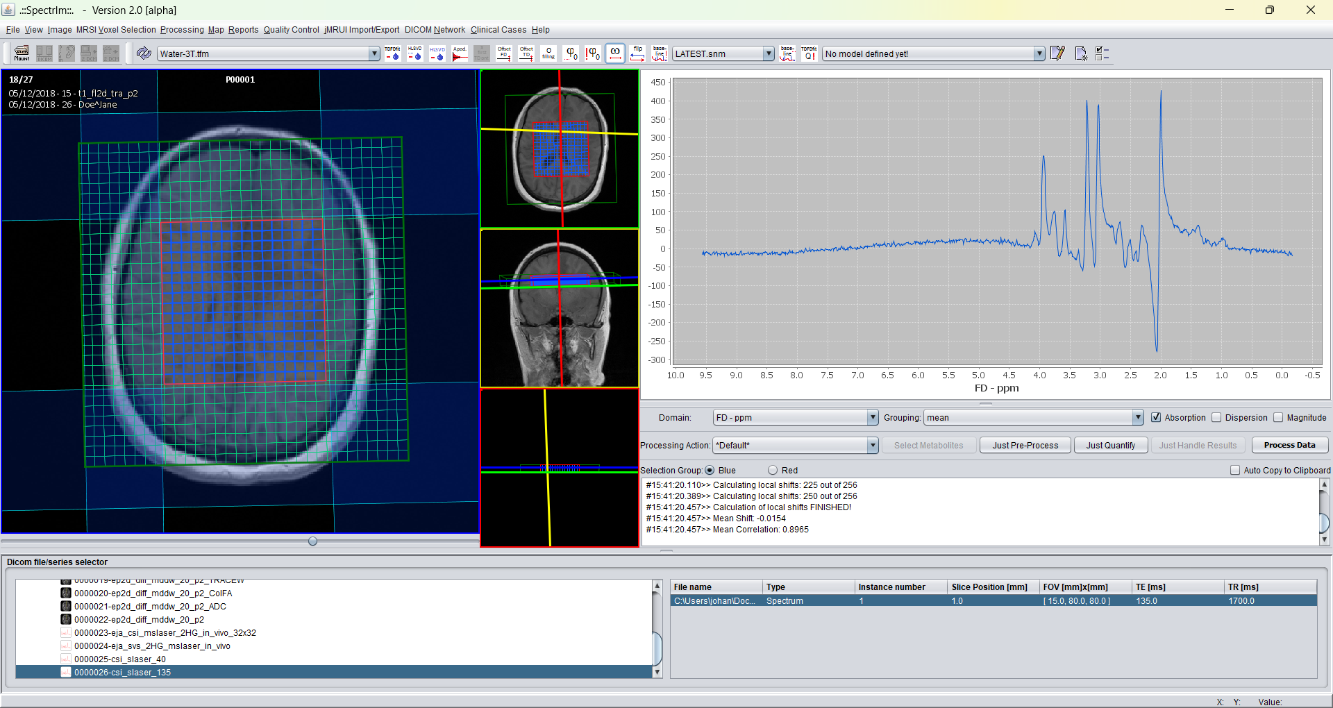 Graphical user interface spectrIm-QMRS after first order phase of 360 degrees on an initially well phased spectrum.