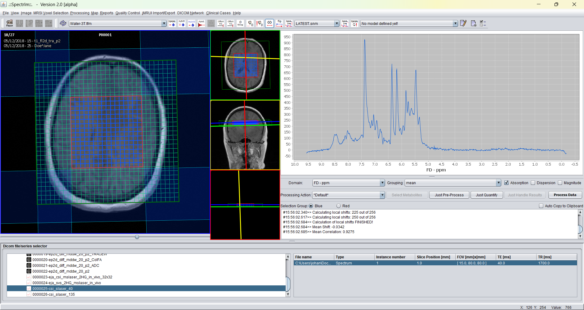 Graphical user interface to set HLSVD filtering properties.