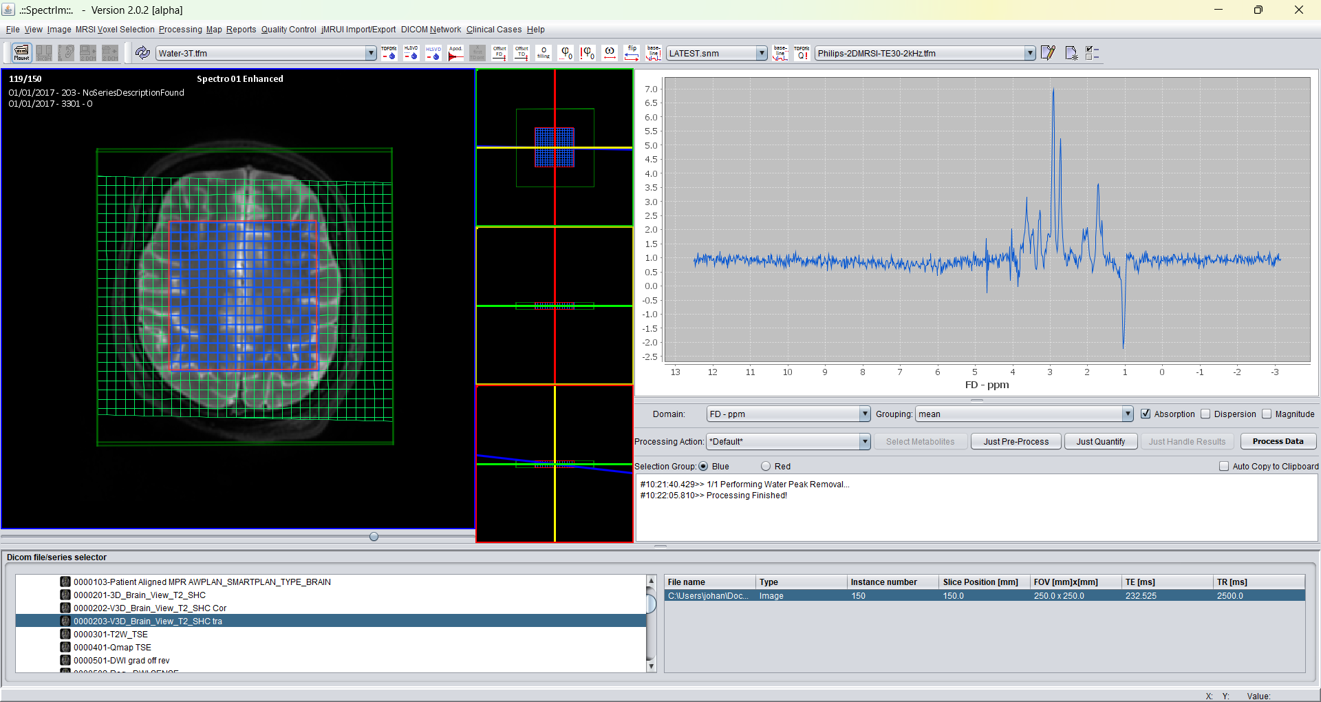 spectrIm-QMRS displaying a processed 2D-MRSI dataset