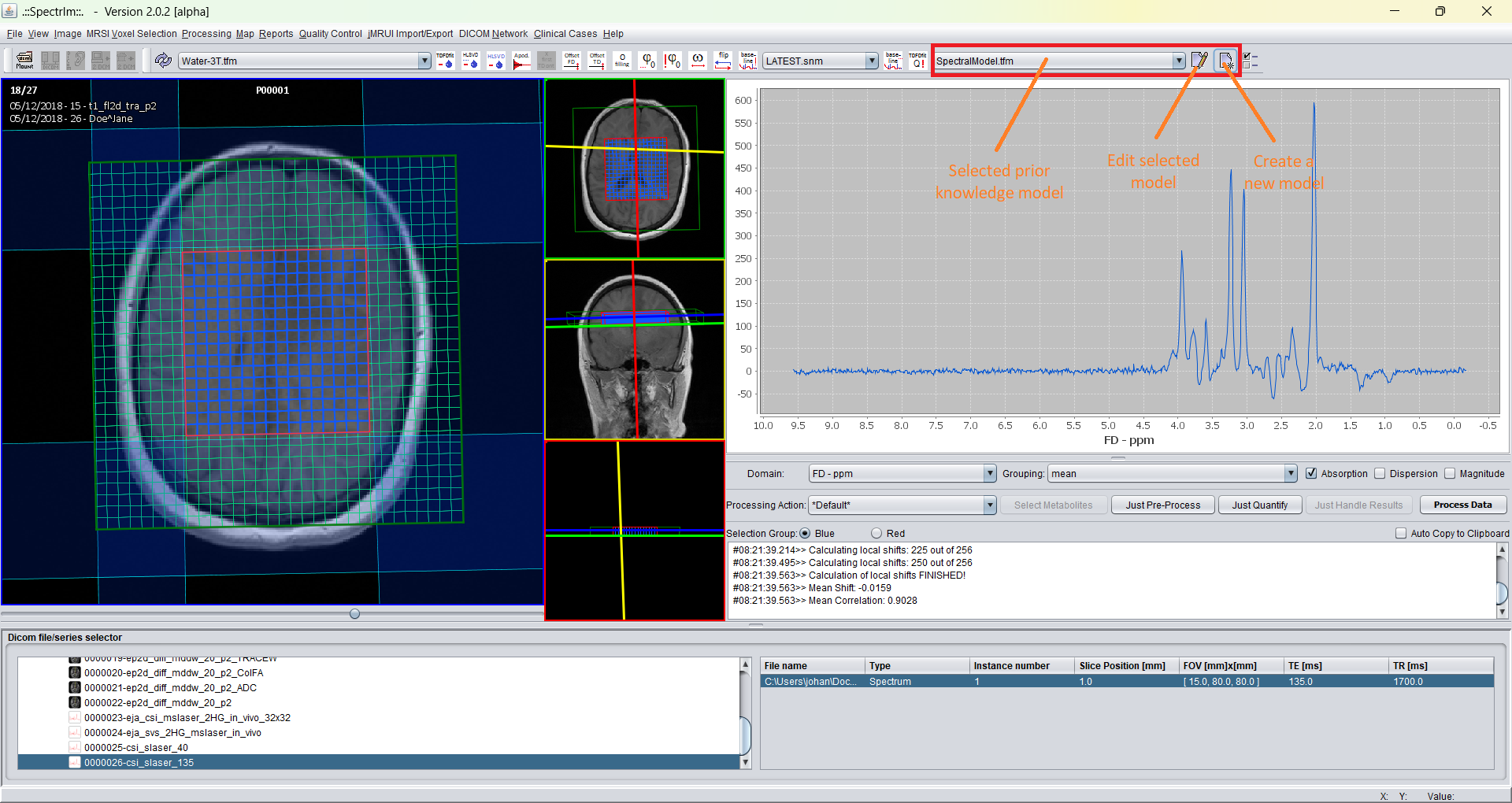 spectrIm-QMRS launching TFDFFitControl modelling tool