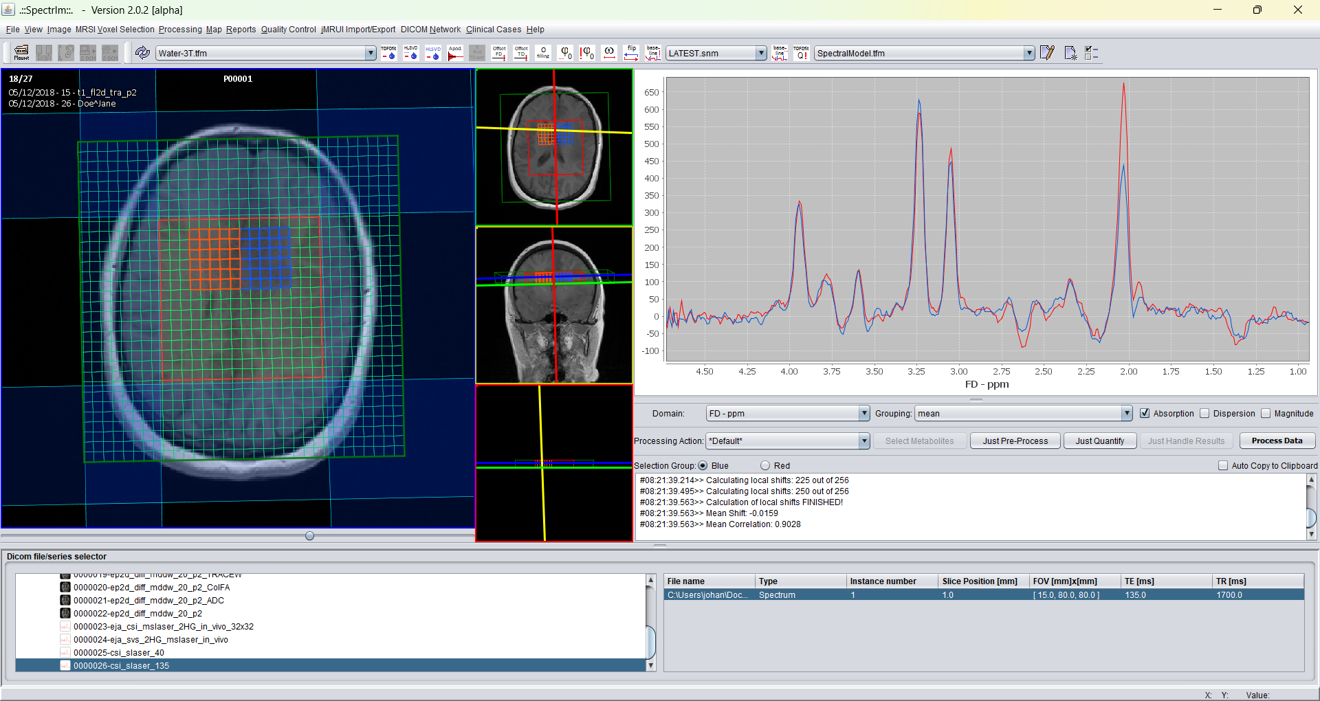 spectrIm-QMRS - simultaneous display of red and blue signal group